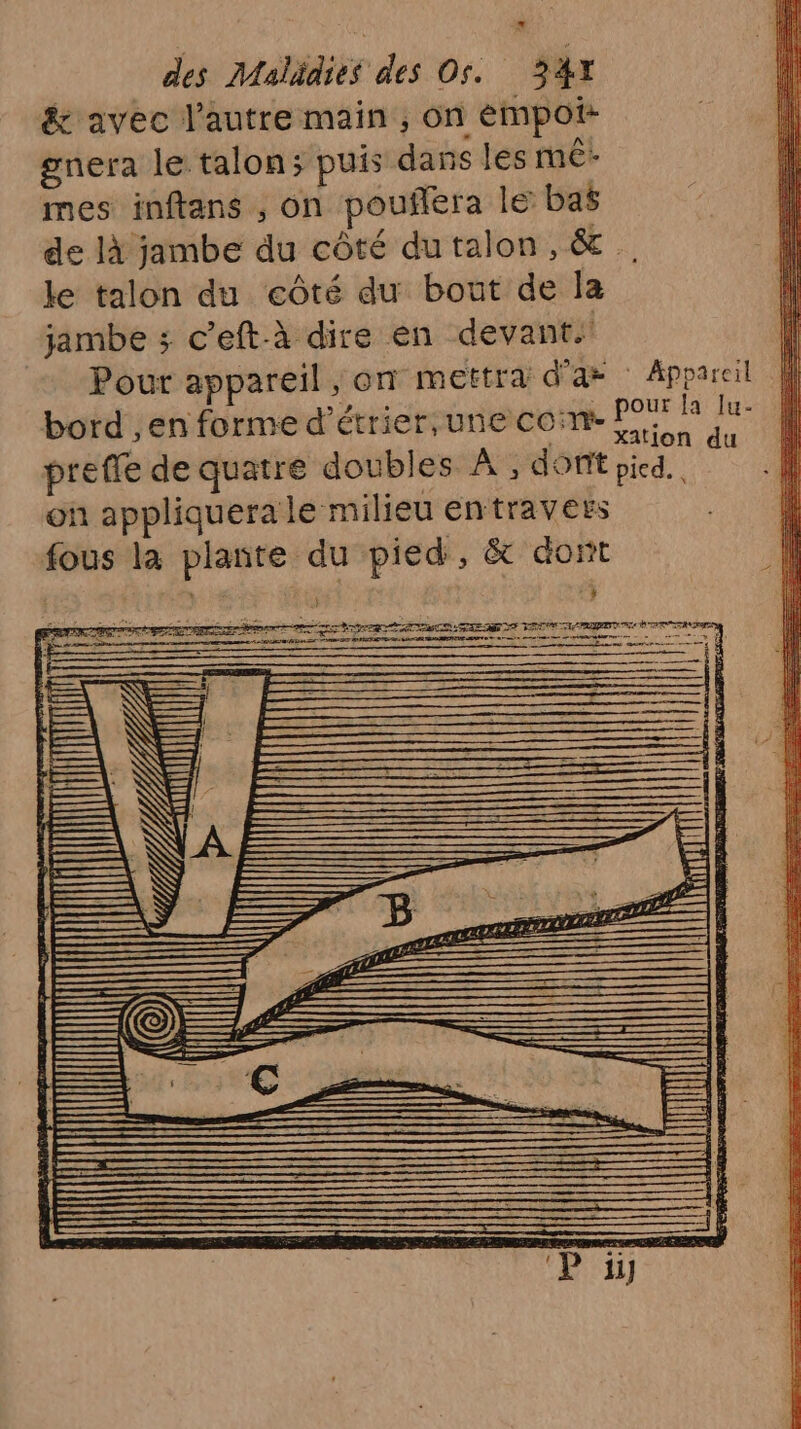 &amp; avec l’autre main , on émpoi- gnera le talon; puis dans les mé mes inftans , on pouflera le bas de là jambe du côté dutalon, &amp; le talon du côté du bout de la jambe ; c’eft-à dire en devant.’ Pour appareil, on mettra d'a : Appareil bord ,en forme d’étrier,une con: is fa preffe de quatre doubles À , dont pied. on appliquera le milieu entravers fous la plante du pied, &amp; dont in T' | | # | \ À \ Fe | (4 RS ! | M $ À rt j À à x | LI | Rh . | | | Le ; | à à | | ! N \l ë | 4 EE. à (à | f K ! 4 $ : \ | : a | ie | k SE < : à ! | : “ ul OC LS ’ _. _— RTC TRUE Le RE ———— | GTR A 3 0 een am Ra CREER AE A LÉ eme-emne ans f > =, a, D Den ARMES D, jee —— = — 1 à === : ne SAVE 1 pr rente - Pr : | . = e