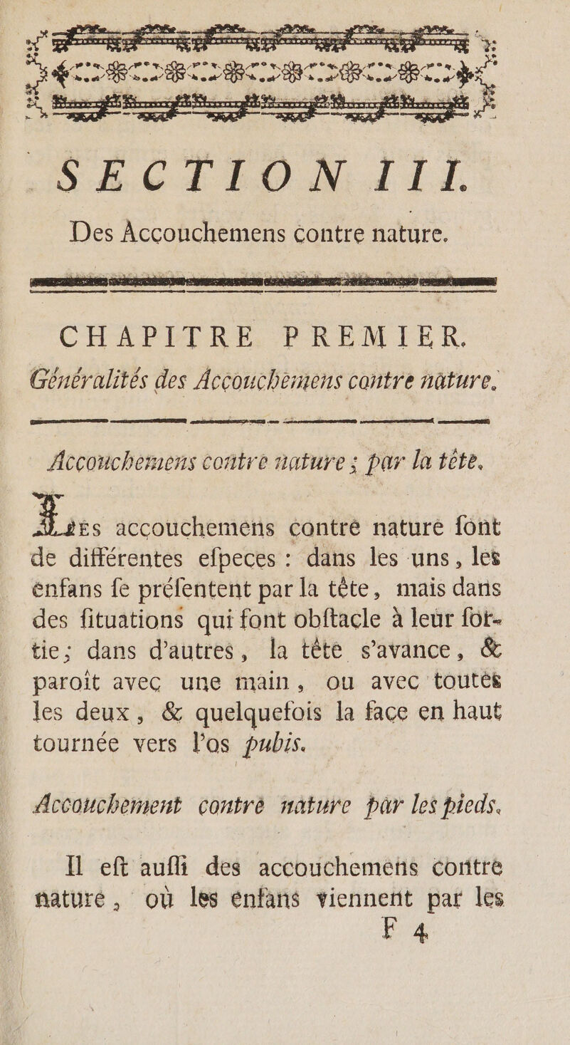 [PP 2% PE %. CERN PS PE © ue à: C0 LTT 6: vent” ARE des” est” C: #DE Fi SEK Le Se Es » {5 rppr 111 Des Accouchemens contre nature. CHAPITRE PREMIER. Généralités des Accouchemens cantre nature. po Accouchemens contre nature : par la tête. ns accouchemens contre nature font de différentes efpeces : dans les uns, let énfans fe préfentent par la tête, mais dans des fituations qui font obftacle à leur füt- tie: dans d’autres, la tête s’avance, &amp; paroît avec une main, ou avec toutés les deux, &amp; quelquefois la face en haut tournée vers l'os pubs. Accouchement contrée nature par les bieds. Il eft aufli des accouchemens contre nature, où les énfans viennent par les F4