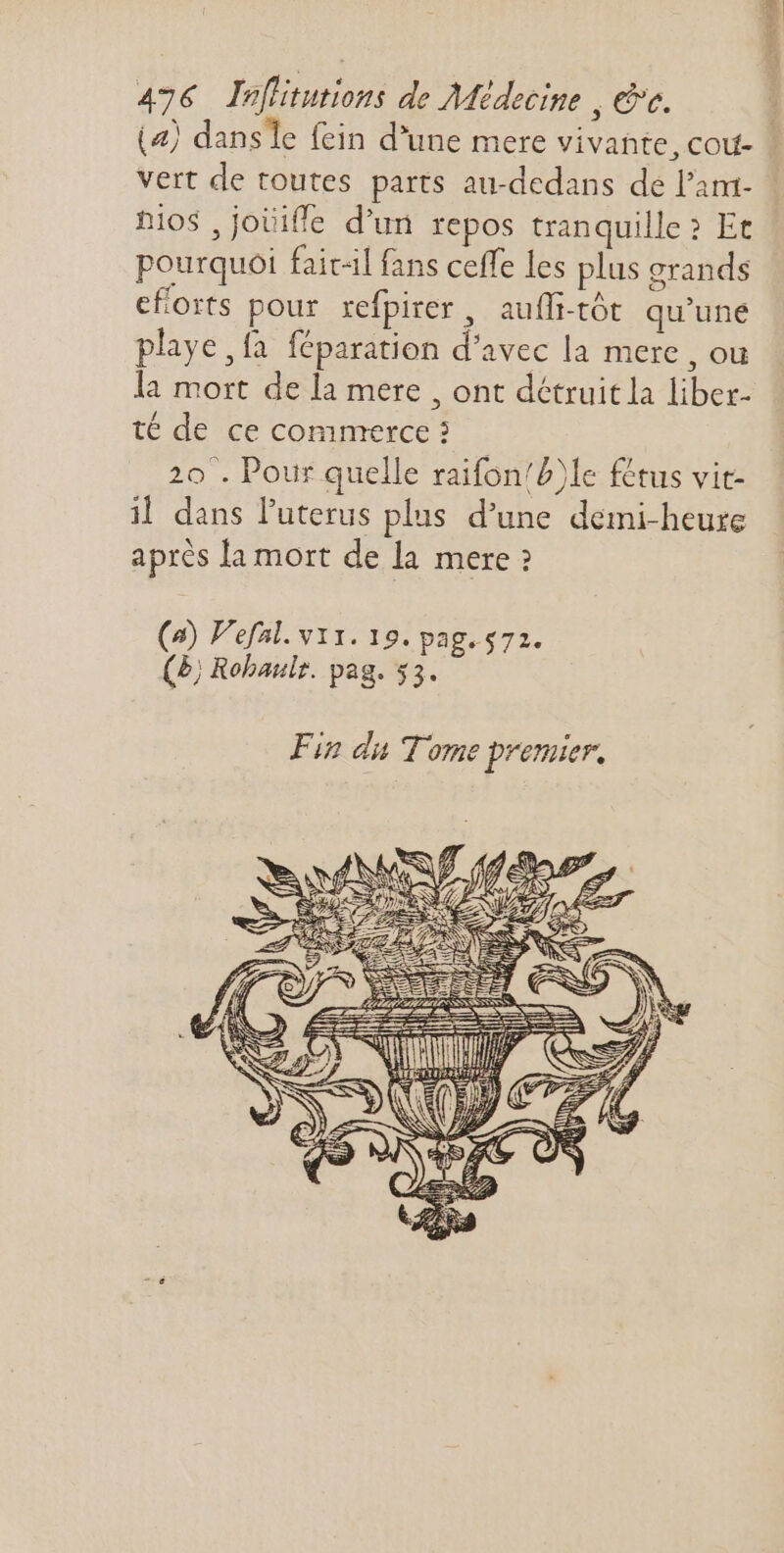 enini vert de toutes parts au-dedans de l'am- Dios ,jotiffe d'un repos tranquille? Et pourquoi fait-il fans ceffe les plus grands eforts pour refpirer , aufli-tôt qu'une playe fa feparation d'avec la mere , ou la mort de la mere , ont détruitla liber- té de ce commerce? 20 . Pour quelle raifon/b)le fetus vit- il dans l'uterus plus d’une demi-heure après la mort de la mere ? (a) Vefal. v11. 19. pag.$72. (5 Robaulr. pag. 53. Fin du Tome premier, ANS AE [ SE «1 je nj Ir 2, MZ 7 ^, SES | Ji [y t LT DR DUE p f D