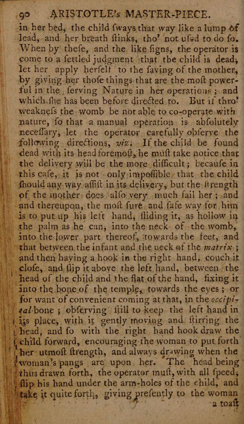 \ bi be bed, the child fways that way like alump of iS fadeads and. ee breath ftinks, tho’ not ufed to do fo. i When by’ thefe, and the like figns, the operator is | come to a fettled judgment.\that the child is dead, | let her apply herfelf to the faving of the mother, : by giving-her thofe things-that are the moft power- ful inthe -ferving Nature in her operations ; and | which the has been before direéted to, But if thro? weakneis the. womb be not able to co-operate with | nature, fo that a manual operation. 1s abfelutely meceffary, let. the Operasor carefully opferve the | following directions, viz Ifthe child be found a dead with its head fot baie: he mutt take notice, that * the delivery awill be the more. difficult ; becaufe in this cafe,,it is not. only, impofible , that the child - “fhould any way-affift. in its.delivery, but the. frength of the, imother: does alfo very much fail her ; ,and Lfi iT? -and. thereupon, the moft fure, and fafe way for, him is to put.up his left hand, fliding it, as hollow 3 i the palm as he can, into the neck of the womb, the lower part thereof, ‘towards the feet, and at betyveen the infant and the ueck of the matrix: ; a d then haying a hook in the right hand, couchit clote,. and, flip it above the left. Hand, between. the d of the child and the flat.of the hand, fixing it. othe, bone of the temple,. towards the eyes 5 or or want of convenient coming at that, in the occ/pis “eal: ‘bone ; obferving {Hill to. keep the left hand in igs place, with, it gently. moving and. ftirring the ead, and fo with the right hand hook draw the aL ild forward, encouraging the woman to put forth’ tmoft ftrength, and always drawing when the 1's pangs are upon. her. “The héad being ° rawn forth, the operator muft, with all fpeed; s hand under the arm-holes of the child, and é ye spuite forth, § giving g prefeatly tc to the woman “a to