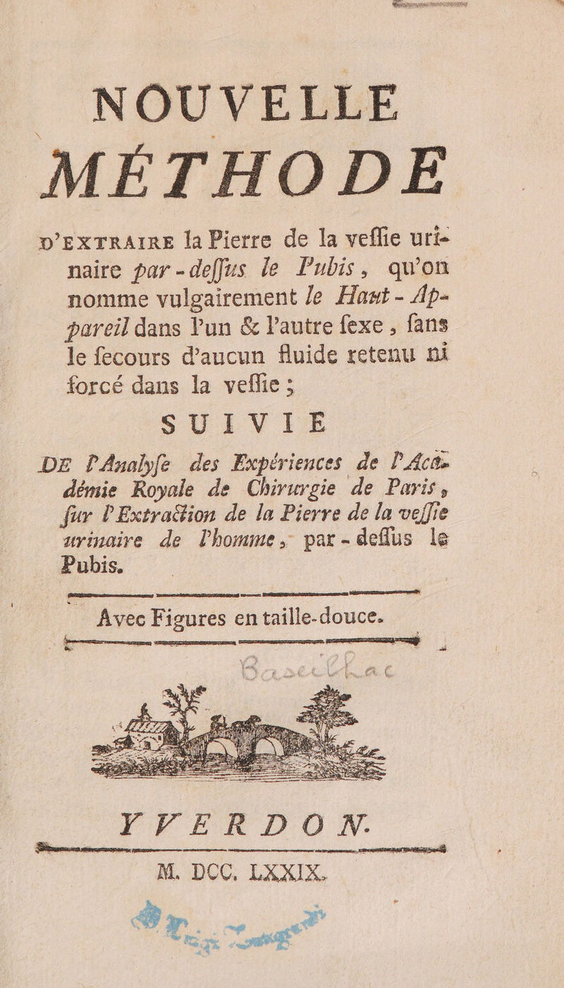D'EXTRAIRE la Pierre de la veflie uri- naire par -deffus le Pubis, qu’on nomme vulgairement Je Hast- Ap- pareil dans Yun &amp; Pautre fexe , fans le fecours d'aucun fluide retenu ni forcé dans la vefle ; SUIVIEÉE DE PAnalyfe des Expériences de l'Acas démie Royale de Chirurgie de Paris, fur PExtradion de la Pierre de la vefjie urinaire de l'homme, par-deflus le Pubis. _ Avec Figures entaille-douce. VE RD O N. M. DOC, LXXIX. am | # | +0 M