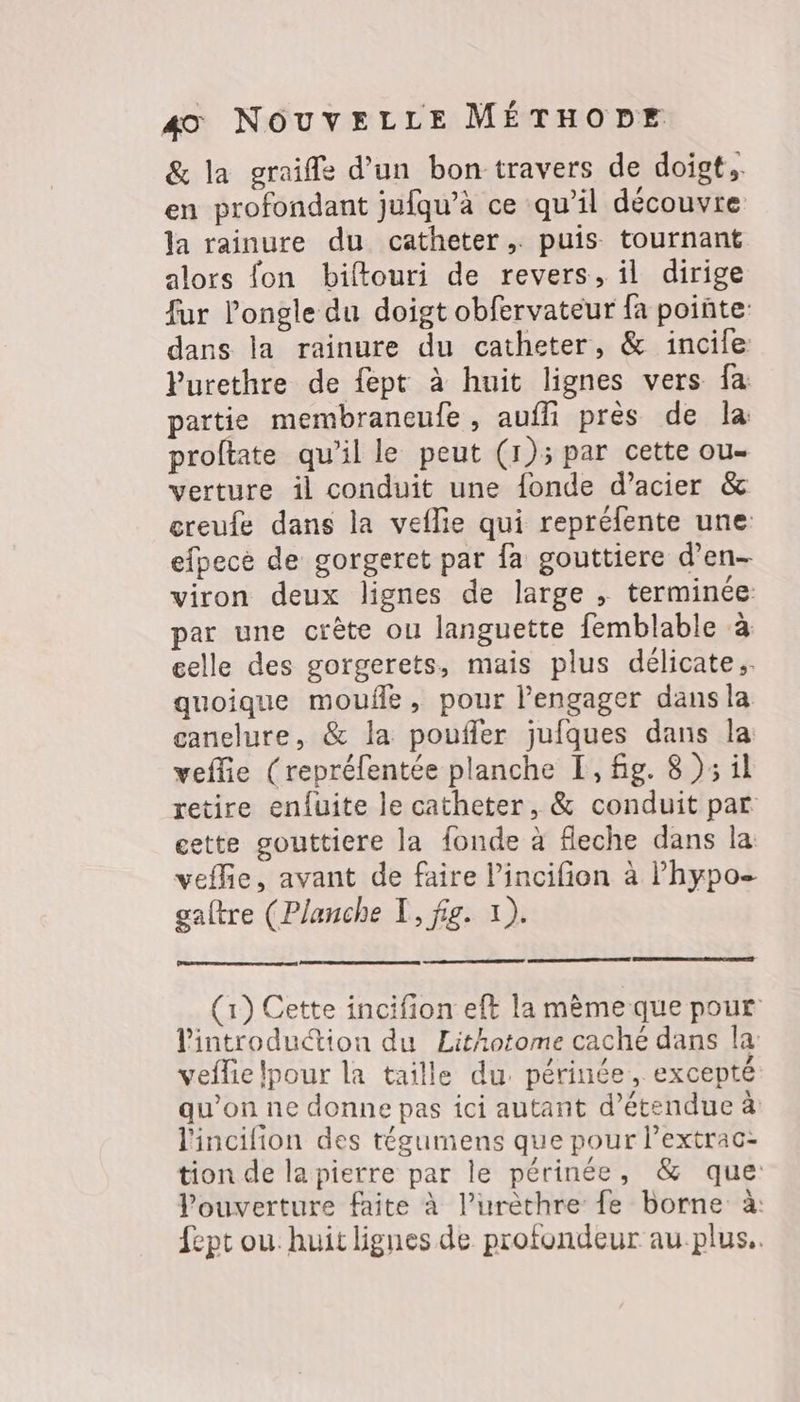 & la graiffe d’un bon-travers de doigt, en profondant jufqu’à ce qu’il découvre la rainure du catheter,. puis tournant alors fon biftouri de revers, il dirige fur l’ongle du doigt obfervateur fa pointe: dans la rainure du catheter, & incile Purethre de fept à huit lignes vers fa partie membraneufe , aufli près de la: proltate qu’il le peut (1): par cette ou- verture il conduit une {onde d’acier & creufe dans la veflie qui repréfente une efpece de gorgeret par fa gouttiere d’en- viron deux lignes de large , terminée par une crête ou languette femblable à celle des gorgerets, mais plus délicate. quoique moule, pour l’engager dans la canelure, & la poufler jufques dans la veflie (reprélentée planche [, fg. 8 )3 il retire enluite le catheter, & conduit par cette gouttiere la fonde à fleche dans la veflie, avant de faire l’incifion à Phypo- gaftre (Planche T, fig. 1). (1) Cette incifion eft la mème que pour l'introduction du Lithotome caché dans la veflie lpour la taille du. périnée, excepté qu’on ne donne pas ici autant d’étendue à lincilion des tégumens que pour l’extrac- tion de la pierre par le périnée, & que: Vouverture faite à l’urèthre fe borne à fept ou huit lignes de profondeur au plus..