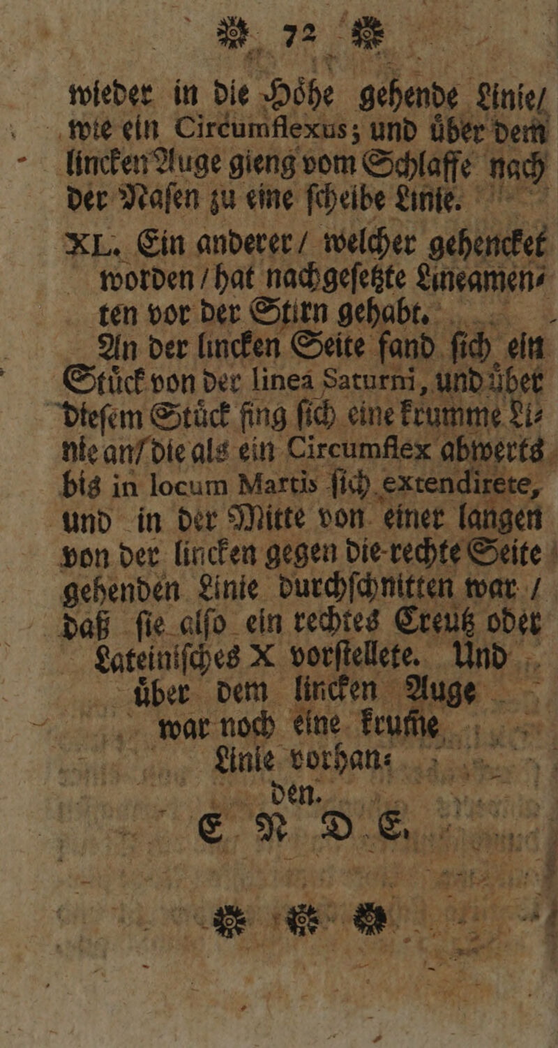 wieder in die Hohe gehende Linie we ein Circumflexus; und über dem lincken Auge gieng vom Schlaffe nach der Naſen zu eine ſchelbe Linie. XL. Ein anderer / welcher gehencket worden / hat nachgefehte Aneamen⸗ ten vor der Stirn gehabt. An der lincken Seite fand ſich ein Stuüͤck von der linea Saturni , und bet dieſem Stück fing fi. eine krumme Li⸗ nie an / die als ein Circumflex abwerts bis in locum Martis fic) extendixete, | und in der Mitte von einer langen von der lincken gegen die rechte Seite gehenden Linie durchſchnitten war / daß ſie alſo ein rechtes Creutz oder Lateiniſches X vorſtellete. Und uͤßber dem pon quor - 8 war noch eine frufe , Ale vor hanf 9o d