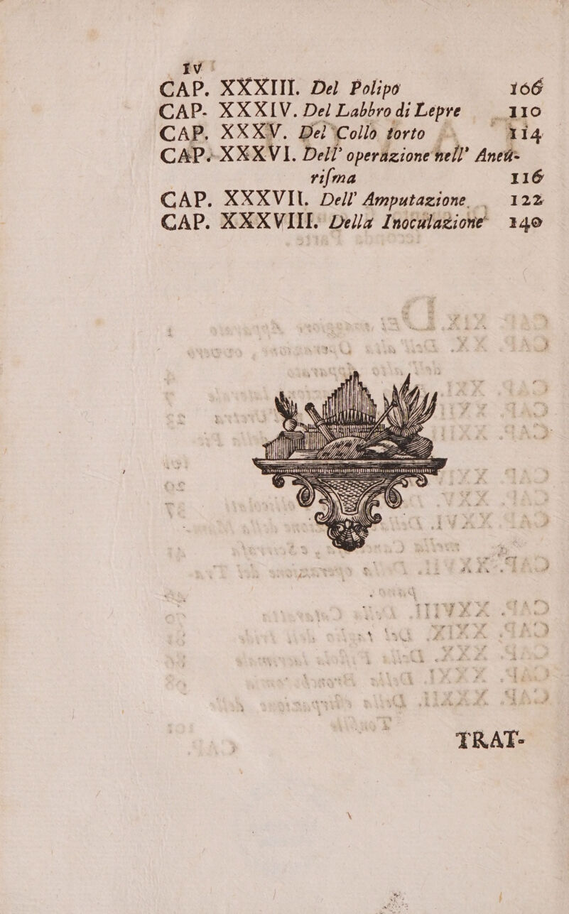 Ivi CAP. XXXIII. Del Polipo 166 CAP. XXXIV. Del Labbro di Lepre 110 CAP, XXXV. Del‘Collo torto | ri4 CAP» XXXVI. Dell’ operazione‘nell’ Anew&gt; rifma 116 CAP. XXXVII. Dell’ Amputazione | 12% CAP. XXXVIII. Della Inoculazione' 140 TRAT-