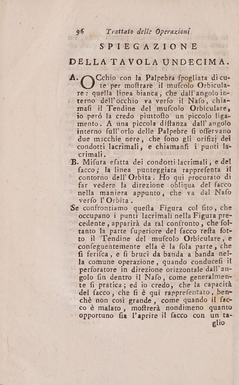 SPIEGAZIONE DELLA TAVOLA UNDECIMA. MA) con la Palpebra fpogliata di cu- te‘per moftrare il mufcolo Orbicula- re: quella linea bianca; che dall'angolo in- .. terno dell’occhio va‘verfo il Nafo, chia» mafi il Tendine del mufcolo Orbiculare; ‘10 però la credo piuttofto un piccolo liga- mento. A una piccola diftanza dall’ angolo interno full’orlo delle Palpebre fi offervano due macchie nere, che fono gli orifizj dei condotti lacrimali; e chiamanfi i punti la- crimali. B. Mifura efatta dei condottilacrimali; e del facco; la linea punteggiata rapprefenta il contorno dell’ Orbita. Ho qui procurato di far vedere la direzione obliqua del facco nella maniera appunto, che va dal Nafo verfo l'Orbita. Se confrontiamo quefta Figura col fito, che occupano i punti lacrimali nella Figura pre- ‘cedente, apparirà da tal confronto, che fol- tanto la parte fuperiore ‘del facco refta fot- to il Tendine del mufcolo Orbiculare, e confeguentemente ella è la fola parte, che fi ferifca, e fi bruci da barida a banda nel- la comune operazione, quando conducefi il perforatore in direzione orizzontale dall’an- golo fin dentro il Nafo, come generalmen- ‘te fi pratica; ed io credo, che la capacità del facco, che fi è qui rapprefentato, ben» chè non così grande, come quando il fac- co è malato, moftrerà nondimeno quanto opportuno fia l’aprire il facco con x: ta- glio