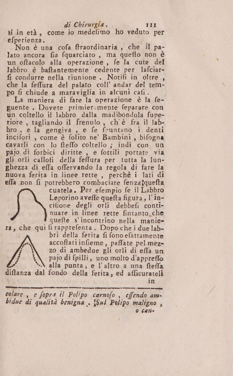 ti in età, come io medefimo ho veduto per efperienza. ‘Non è una cofa ftraordinaria , che il pa- lato ancora fia fquarciato , ma quefto non è un oftacolo alla operazione , fe la cute del labbro è baftantemente cedente per lafciar- fi condurre nella riunione . Notifi in oltre, che la feffura del palato coll’ andar del tem- | po fi chiude a maraviglia in alcuni cali. La maniera di fare la operazione è la fe- guente . Dovete primieramente feparare con un coltello il labbro dalla madibondola fupe- riore , tagliando il frenulo, ch'è fra il lab- bro, e la gengiva , € fe fpuntano 1 denti incifori , come è folito ne? Bambini, bifogna cavarli con lo fleffo coltello ; indi con un pajo di forbici diritte , e fottili portate via ‘ gli orli callofi della fefura per tutta la lun- ghezza di effa offervando la regola di fare la nuova ferita in linee rette , perchè i lati di effa non fi potrebbero combaciare fenzafquefta cuatela. Per efempio fe il Labbro Leporino aveffe quefta figura, l’in- cifione degli orli debbefi conti- nuare in linee rette fintanto, che quefte s’ incontrino nella manie- ra, che qui fi rapprefenta, Dopo che i due lab- \ i bri della ferita fi fono efattamente | accoftatiinfieme, paffate pel meze zo di ambedue gli orli di effa un pajo di fpilli, uno molto d’appreffo A alla punta, e l’altro a una fteffa. diftanza dal fondo della ferita, ed afficurateli in colare se fopra LI) Polipo dine , effendo 4m- bidue di qualità benigna . Sul Polipo maligno , 0 cat