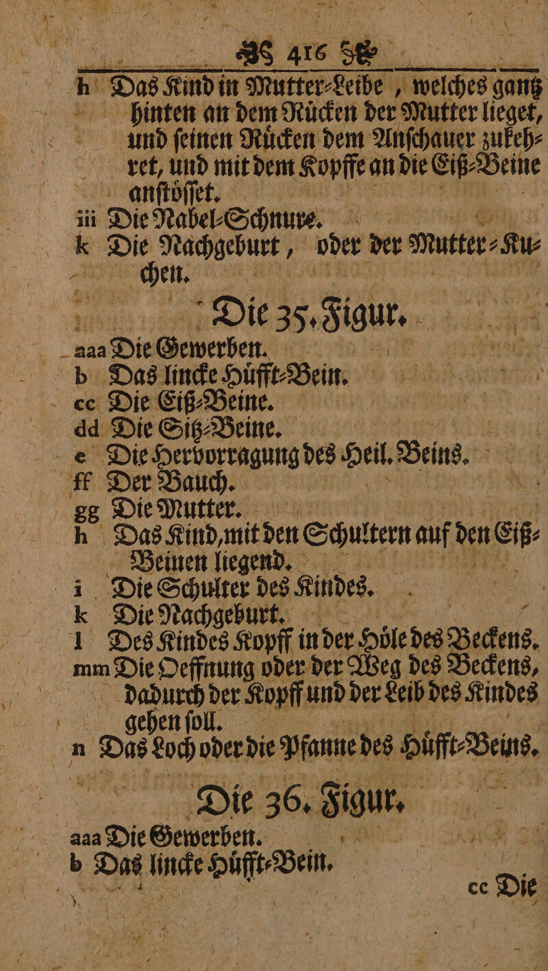 — — nn ET 416 3 5. De 85 moin n Mutter⸗Leibe 15 155 Some hinten an dem Rücken der Mutter lieget, und ſeinen Ruͤcken dem Anſchauer zukeh⸗ ret, und mit dem Kopff an die Eiß⸗ Beine anſtoͤſſꝶetr iii Die Nabel⸗Schnure. * or ehe ; ober der mutter Sr ARG. Die 35. Sigur. g 7 Serben: yes Amor b Das . EN en ce Die Eiß⸗Beine. dd Die Sitz⸗ Beine. er . Die Herhorragung des Sei Bei. B; Die Mutter. Das Kind, mit den Schultern auf ben ci Beinen liegend. Die Schulter des Kindes. a Die Nachgeburt. „ 1 Des Kindes Koyff in der Höle des Beckens. mm Die Oeffnung oder der Weg des Beckens, | de nice ee dees Ae n „ oder die Dannedes biff. Bous. Die 36. Sigur. * 2 85 des Die Gewerben. . * Be me Sue Bein, ” . ce Die