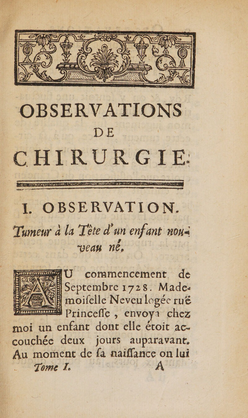 OBSERVATIONS DE CHIRURGIE I OBSERVATION. Tumeur à la Tète d'un enfant nou< veas ne, | FN | Pda envoy ae moi un enfant dont elle étoit ac- _ couchée deux jours auparavant, Au moment de fa naiflance on lui
