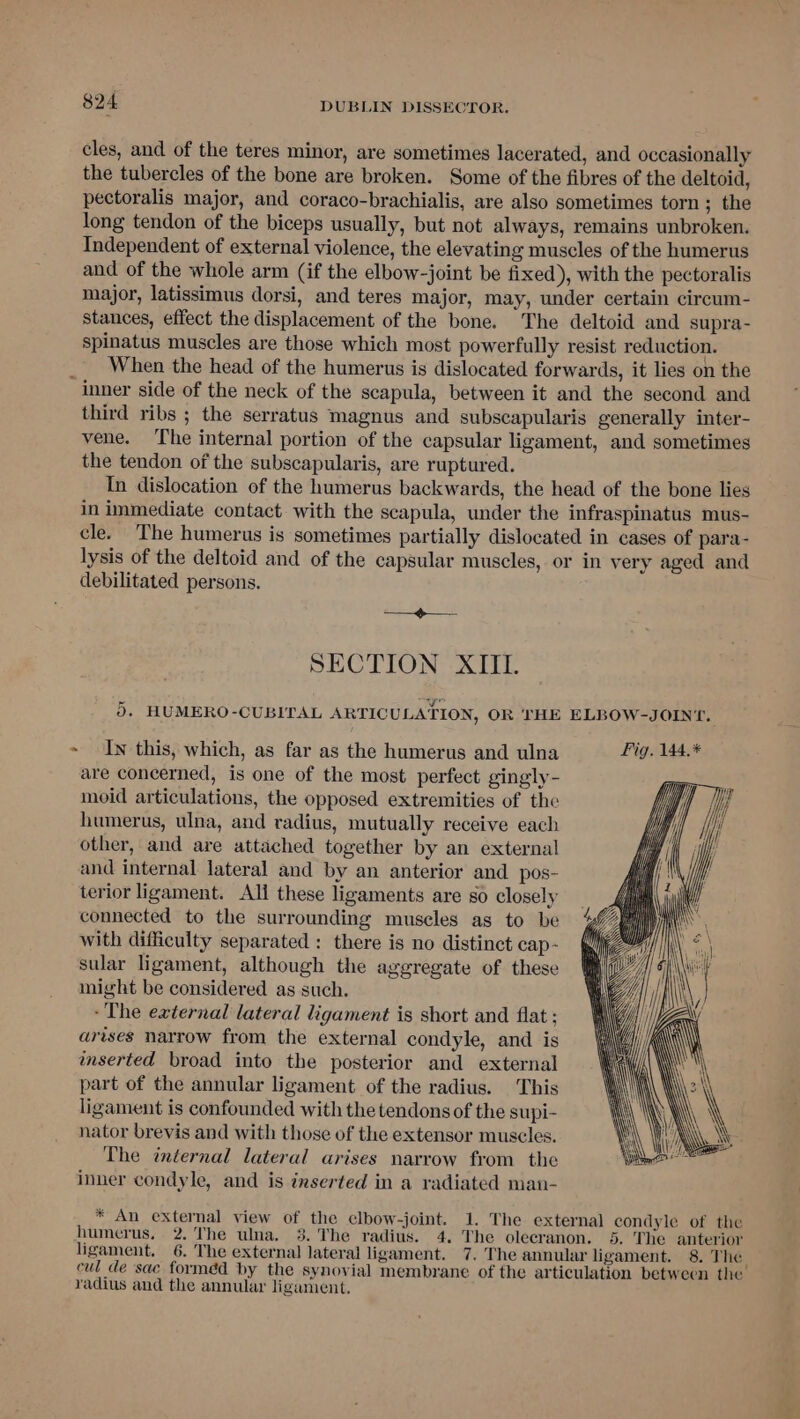 cles, and of the teres minor, are sometimes lacerated, and occasionally the tubercles of the bone are broken. Some of the fibres of the deltoid, pectoralis major, and coraco-brachialis, are also sometimes torn; the long tendon of the biceps usually, but not always, remains unbroken. Independent of external violence, the elevating muscles of the humerus and of the whole arm (if the elbow-joint be fixed), with the pectoralis major, latissimus dorsi, and teres major, may, under certain circum- stances, effect the displacement of the bone. The deltoid and supra- spinatus muscles are those which most powerfully resist reduction. __ When the head of the humerus is dislocated forwards, it lies on the inner side of the neck of the scapula, between it and the second and third ribs ; the serratus magnus and subscapularis generally inter- vene. ‘The internal portion of the capsular ligament, and sometimes the tendon of the subscapularis, are ruptured. In dislocation of the humerus backwards, the head of the bone lies in immediate contact with the scapula, under the infraspinatus mus- cle. The humerus is sometimes partially dislocated in cases of para- lysis of the deltoid and of the capsular muscles, or in very aged and debilitated persons. coe teers SECTION XIII. rr Pen if hs 0. HUMERO-CUBITAL ARTIC ULATION, OR THE ELBOW-JOIN‘T. > In this, which, as far as the humerus and ulna Pig. 144.* are concerned, is one of the most perfect gingly- moid articulations, the opposed extremities of the humerus, ulna, and radius, mutually receive each other, and are attached together by an external and internal lateral and by an anterior and pos- terior ligament. All these ligaments are so closely connected to the surrounding muscles as to be with difficulty separated: there is no distinct cap- sular ligament, although the aggregate of these might be considered as such. ~The external lateral ligament is short and flat ; arises narrow from the external condyle, and is inserted broad into the posterior and external part of the annular ligament of the radius. This ligament is confounded with the tendons of the supi- nator brevis and with those of the extensor muscles. The internal lateral arises narrow from the inner condyle, and is inserted in a radiated man- * An external view of the clbow-joint. 1. The external condyle of the humerus, 2. The ulna. 3. The radius. 4. The olecranon. 5. The anterior ligament. 6. The external lateral ligament. 7. The annular ligament. 8. The cul de sac forméd by the synovial membrane of the articulation between the radius and the annular ligament,