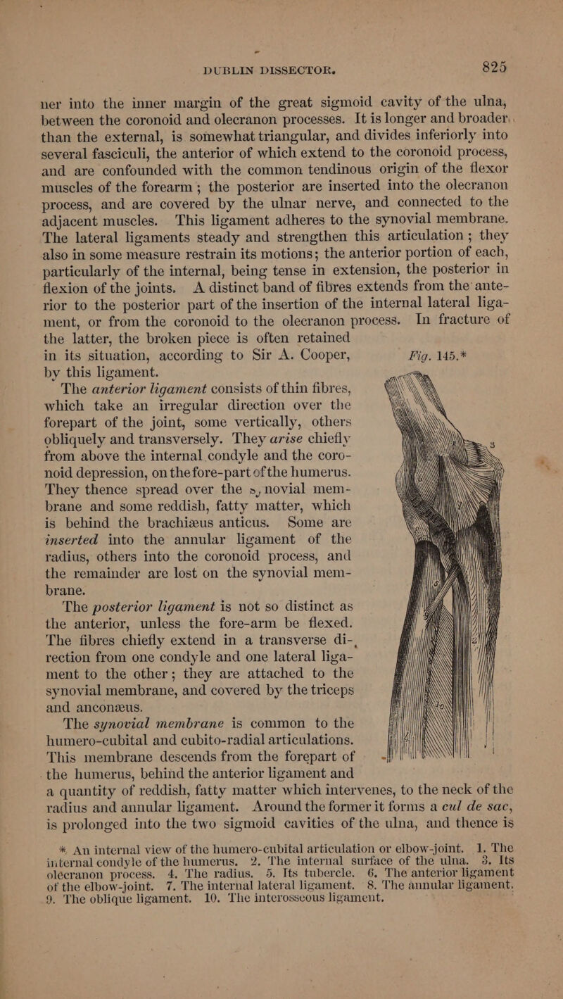 - DUBLIN DISSECTOR. 825 ner into the inner margin of the great sigmoid cavity of the ulna, between the coronoid and olecranon processes. It is longer and broader, than the external, is somewhat triangular, and divides inferiorly into several fasciculi, the anterior of which extend to the coronoid process, and are confounded with the common tendinous origin of the flexor muscles of the forearm ; the posterior are inserted into the olecranon process, and are covered by the ulnar nerve, and connected to the adjacent muscles. This ligament adheres to the synovial membrane. The lateral ligaments steady and strengthen this articulation ; they also in some measure restrain its motions; the anterior portion of each, particularly of the internal, being tense in extension, the posterior in flexion of the joints. A distinct band of fibres extends from the’ ante- rior to the posterior part of the insertion of the internal lateral liga- ment, or from the coronoid to the olecranon process. In fracture of the latter, the broken piece is often retained in its situation, according to Sir A. Cooper, Fig. 145.* by this ligament. The anterior ligament consists of thin fibres, which take an irregular direction over the forepart of the joint, some vertically, others obliquely and transversely. They arise chiefly from above the internal condyle and the coro- noid depression, on the fore-part ofthe humerus. They thence spread over the », novial mem- brane and some reddish, fatty matter, which is behind the brachizeus anticus. Some are inserted into the annular ligament of the radius, others into the coronoid process, and the remainder are lost on the synovial mem- brane. The posterior ligament is not so distinct as the anterior, unless the fore-arm be flexed. The fibres chiefly extend in a transverse di-, rection from one condyle and one lateral liga- ment to the other; they are attached to the synovial membrane, and covered by the triceps and anconzus. The synovial membrane is common to the humero-cubital and cubito-radial articulations. This membrane descends from the forepart of -the humerus, behind the anterior ligament and a quantity of reddish, fatty matter which intervenes, to the neck of the radius and annular ligament. Around the former it forms a cul de sac, is prolonged into the two sigmoid cavities of the ulna, and thence is * An internal view of the humero-cubital articulation or elbow-joint. 1. The internal condyle ef the humerus. 2. The internal surface of the ulna, 3. Its olécranon process. 4. The radius. 5. Its tubercle. 6. The anterior ligament of the elbow-joint. 7. The internal lateral ligament. 8. The annular ligament,