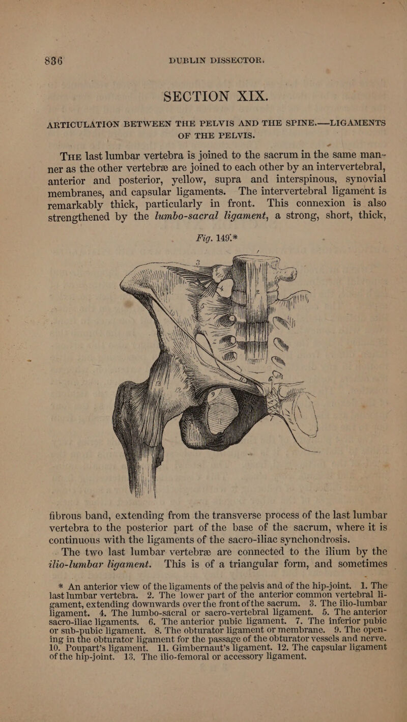 SECTION XIX. ARTICULATION BETWEEN THE PELVIS AND THE SPINE.—LIGAMENTS OF THE PELVIS. Tue last lumbar vertebra is joined to the sacrum in the same man~- ner as the other vertebrz are joined to each other by an intervertebral, anterior and posterior, yellow, supra and interspinous, synovial membranes, and capsular ligaments. The intervertebral ligament is remarkably thick, particularly in front. This connexion is also strengthened by the lumbo-sacral ligament, a strong, short, thick, Fig. 149.* vil | ie a) f Zin 4 7} it \ fibrous band, extending from the transverse process of the last lumbar vertebra to the posterior part of the base of the sacrum, where it is continuous with the ligaments of the sacro-iliac synchondrosis. - The two last lumbar vertebra are connected to the ilium by the ilio-lumbar ligament. ‘This is of a triangular form, and sometimes | * An anterior view of the ligaments of the pelvis and of the hip-joint. 1. The last lumbar vertebra. 2. The lower part of the anterior common vertebral li- gament, extending downwards over the front ofthe sacrum. 3. The ilio-lumbar ligament. 4. The lumbo-sacral or sacro-vertebral ligament. 5. The anterior sacro-iliac ligaments. 6. The anterior pubic ligament. 7. The inferior pubic or sub-pubic ligament. 8. The obturator ligament ormembrane. 9. The open- ing in the obturator ligament for the passage of the obturator vessels and nerve. 10. Poupart’s ligament. 11. Gimbernaut’s ligament. 12, The capsular ligament of the hip-joint. 13, The ilio-femoral or accessory ligament,