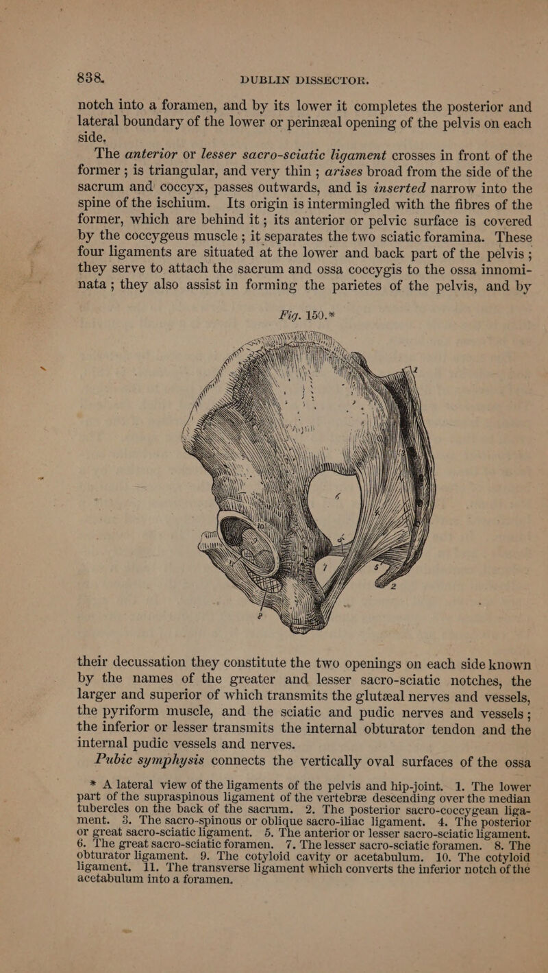 notch into a foramen, and by its lower it completes the posterior and lateral boundary of the lower or perinzeal opening of the pelvis on each side, The anterior or lesser sacro-sciatic ligament crosses in front of the former ; is triangular, and very thin ; arises broad from the side of the sacrum and coccyx, passes outwards, and is inserted narrow into the spine of the ischium. Its origin is intermingled with the fibres of the former, which are behind it ; its anterior or pelvic surface is covered by the coccygeus muscle ; it separates the two sciatic foramina. These four ligaments are situated at the lower and back part of the pelvis ; they serve to attach the sacrum and ossa coccygis to the ossa innomi- nata ; they also assist in forming the parietes of the pelvis, and by Fig. 159.* <ce etic ly RU, x han Gi re H hy) NTE, Aarti . aN uw RR \ NM YY : | ni ne  a i their decussation they constitute the two openings on each side known by the names of the greater and lesser sacro-sciatic notches, the larger and superior of which transmits the gluteal nerves and vessels, the pyriform muscle, and the sciatic and pudic nerves and vessels ; the inferior or lesser transmits the internal obturator tendon and the internal pudic vessels and nerves. Pubic symphysis connects the vertically oval surfaces of the ossa * A lateral view of the ligaments of the pelvis and hip-joint. 1. The lower part of the supraspinous ligament of the vertebre descending over the median tubercles on the back of the sacrum. 2. The posterior sacro-coccygean liga- ment. 3. The sacro-spinous or oblique sacro-iliac ligament. 4. The posterior or great sacro-sciatic ligament. 5. The anterior or lesser sacro-sciatic ligament. 6. The great sacro-sciatic foramen. 7. The lesser sacro-sciatic foramen. 8. The obturator ligament. 9. The cotyloid cavity or acetabulum. 10. The cotyloid ligament. 11. The transverse ligament which converts the inferior notch of the acetabulum into a foramen.