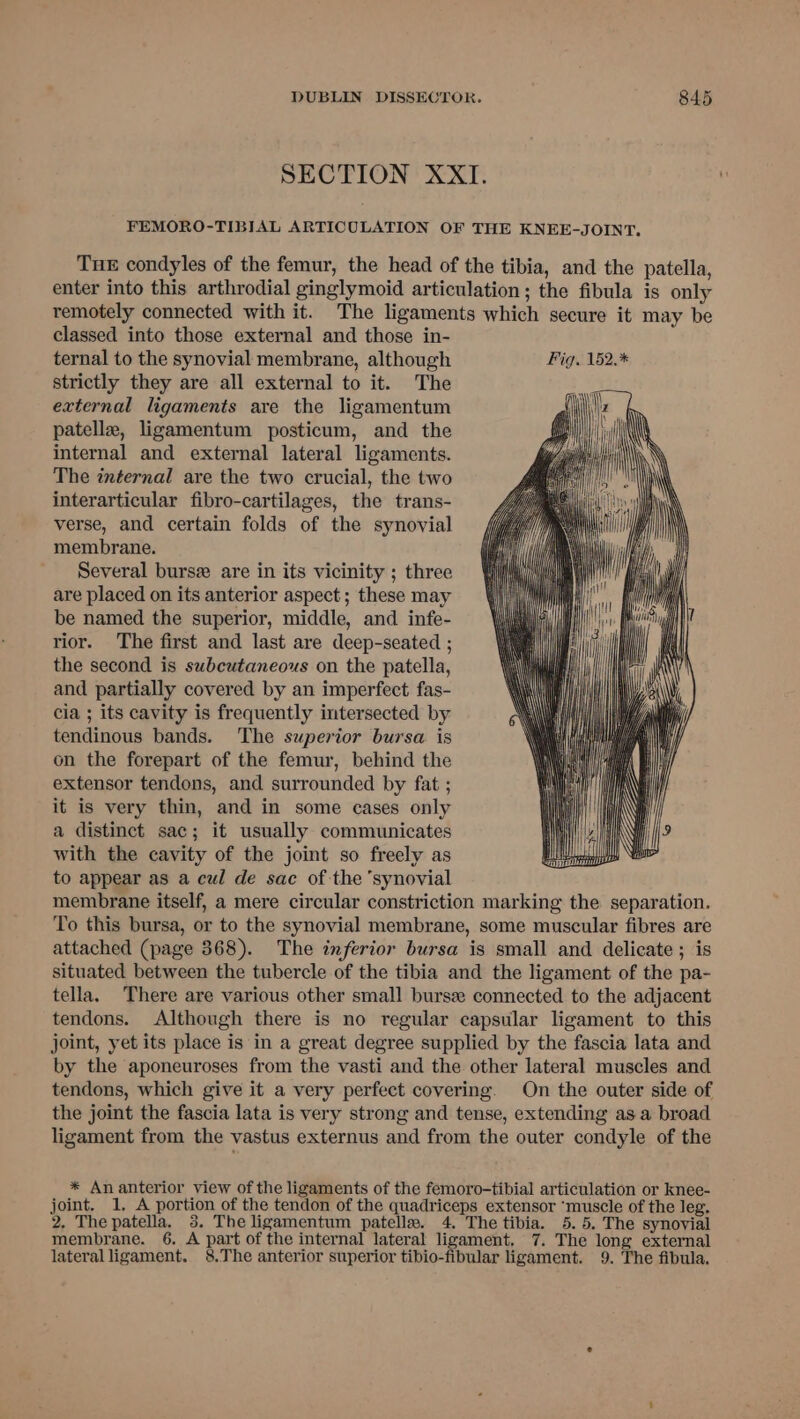 SECTION XXI. FEMORO-TIBIAL ARTICULATION OF THE KNEE-JOINT, Tue condyles of the femur, the head of the tibia, and the patella, enter into this arthrodial ginglymoid articulation; the fibula is only remotely connected with it. The ligaments which secure it may be classed into those external and those in- ternal to the synovial membrane, although Fig. 152.* strictly they are all external to it. The external ligaments are the ligamentum patelle, ligamentum posticum, and the internal and external lateral ligaments. The internal are the two crucial, the two interarticular fibro-cartilages, the trans- verse, and certain folds of the synovial membrane. Several bursz are in its vicinity ; three are placed on its anterior aspect ; these may be named the superior, middle, and infe- rior. The first and last are deep-seated ; the second is subcutaneous on the patella, and partially covered by an imperfect fas- cia ; its cavity is frequently intersected by tendinous bands. The superior bursa is on the forepart of the femur, behind the extensor tendons, and surrounded by fat ; it is very thin, and in some cases only a distinct sac; it usually communicates with the cavity of the joint so freely as to appear as a cul de sac of the ‘synovial membrane itself, a mere circular constriction marking the separation. To this bursa, or to the synovial membrane, some muscular fibres are attached (page 368). The inferior bursa is small and delicate ; is situated between the tubercle of the tibia and the ligament of the pa- tella. There are various other small bursz connected to the adjacent tendons. Although there is no regular capsular ligament to this joint, yet its place is in a great degree supplied by the fascia lata and by the aponeuroses from the vasti and the other lateral muscles and tendons, which give it a very perfect covering. On the outer side of the joint the fascia lata is very strong and tense, extending asa broad ligament from the vastus externus and from the outer condyle of the * An anterior view of the ligaments of the femoro-tibial articulation or knee- joint. 1, A portion of the tendon of the quadriceps extensor ‘muscle of the leg. 2. The patella. 38. The ligamentum patella. 4, The tibia. 5.5. The synovial membrane. 6, A part of the internal lateral ligament. 7. The long external lateral ligament. 8.The anterior superior tibio-fibular ligament. 9. The fibula.