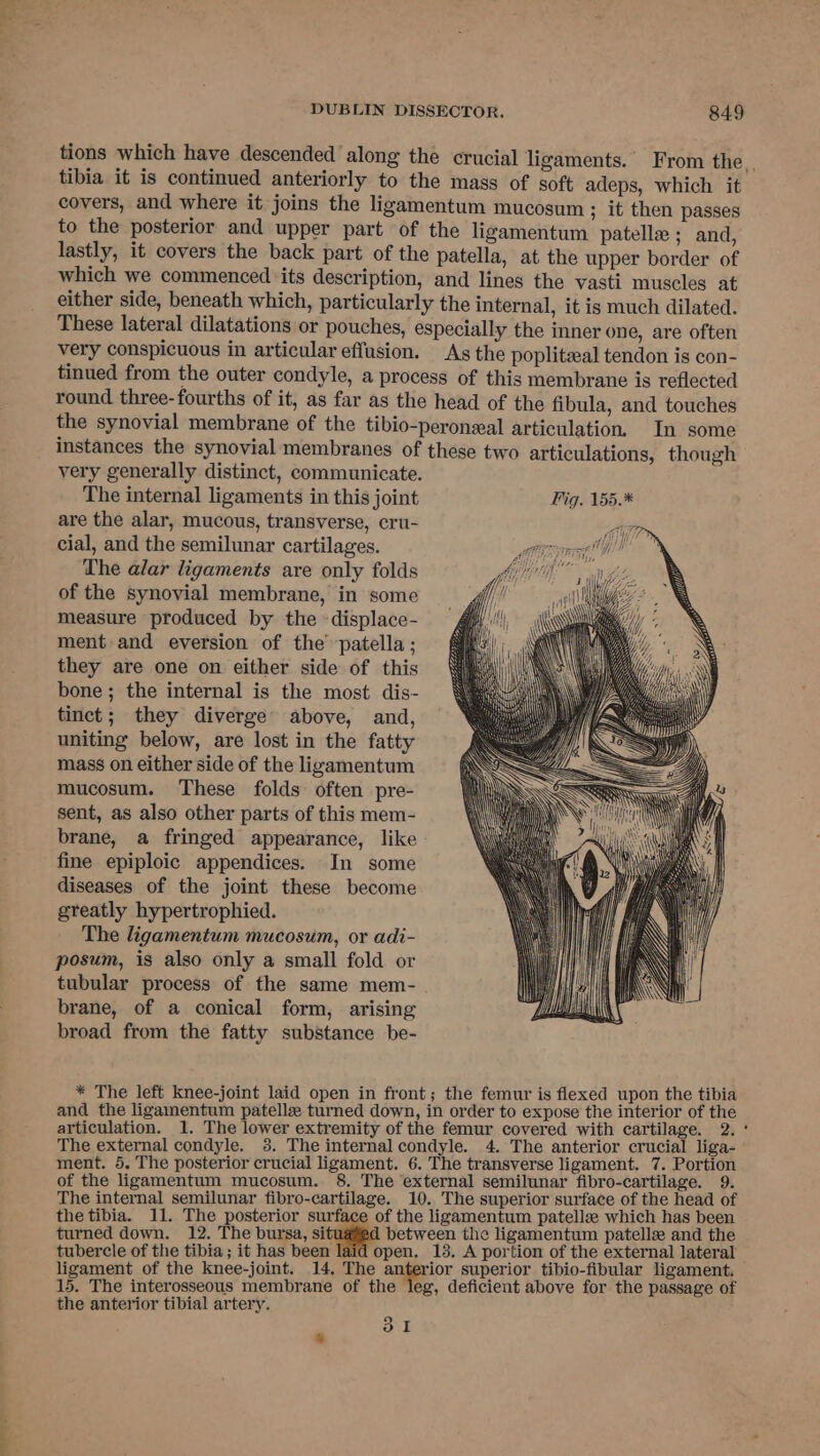 tions which have descended along the crucial ligaments. From the, tibia it is continued anteriorly to the mass of soft adeps, which it covers, and where it joins the ligamentum mucosum ; it then passes to the posterior and upper part of the ligamentum patella ; and, lastly, it covers the back part of the patella, at the upper border of which we commenced its description, and lines the vasti muscles at either side, beneath which, particularly the internal, it is much dilated. These lateral dilatations or pouches, especially the inner one, are often very conspicuous in articular effusion. As the poplitzal tendon is con- tinued from the outer condyle, a process of this membrane is reflected round three-fourths of it, as far as the head of the fibula, and touches the synovial membrane of the tibio-peroneal articulation. In some instances the synovial membranes of these two articulations, though very generally distinct, communicate. ; The internal ligaments in this joint Fig. 155.* are the alar, mucous, transverse, cru- ” cial, and the semilunar cartilages. The alar ligaments are only folds of the synovial membrane, in some measure produced by the -displace- ment and eversion of the’ patella ; they are one on either side of this bone; the internal is the most dis- tinct; they diverge above, and, uniting below, are lost in the fatty mass on either side of the ligamentum mucosum. These folds often pre- sent, as also other parts of this mem- brane, a fringed appearance, like fine epiploic appendices. In some diseases of the joint these become greatly hypertrophied. The ligamentum mucosum, or adi- posum, is also only a small fold or tubular process of the same mem- brane, of a conical form, arising broad from the fatty substance be- AN * The left knee-joint laid open in front; the femur is flexed upon the tibia and the ligamentum patelle turned down, in order to expose the interior of the articulation. 1. The lower extremity of the femur covered with cartilage. 2. ° The external condyle. 8. The internalcondyle. 4. The anterior crucial liga- ment. 5. The posterior crucial ligament. 6. The transverse ligament. 7. Portion of the ligamentum mucosum. 8. The ‘external semilunar fibro-cartilage. 9. The internal semilunar fibro-cartilage. 10. The superior surface of the head of the tibia. 11. The posterior surface of the ligamentum patelle which has been turned down. 12. The bursa, situated between the ligamentum patelle and the tubercle of the tibia ; it has been laid open. 13. A portion of the external lateral ligament of the knee-joint. 14. The erior superior tibio-fibular ligament. 15. The interosseous membrane of the leg, deficient above for the passage of the anterior tibial artery. 31