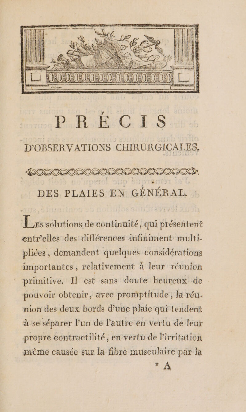 | COPTRPPTRTPTR TE Deer DES PLAIES EN GÉNÉRAL. Lis solutions de continuité, qui présentent entr’elles des différences infiniment multi. pliées, demandent quelques considérations importantes, relativement à leur réunion primitive. Il est sans doute heureux de pouvoir obtenir, avec promptitude, la réu- nion des deux bords d’une plaie qui tendent à se séparer l’un de l’autre en vertu de leur propre contractilité, en vertu de l’irritation mème causée sur la fibre musculaire par la FR