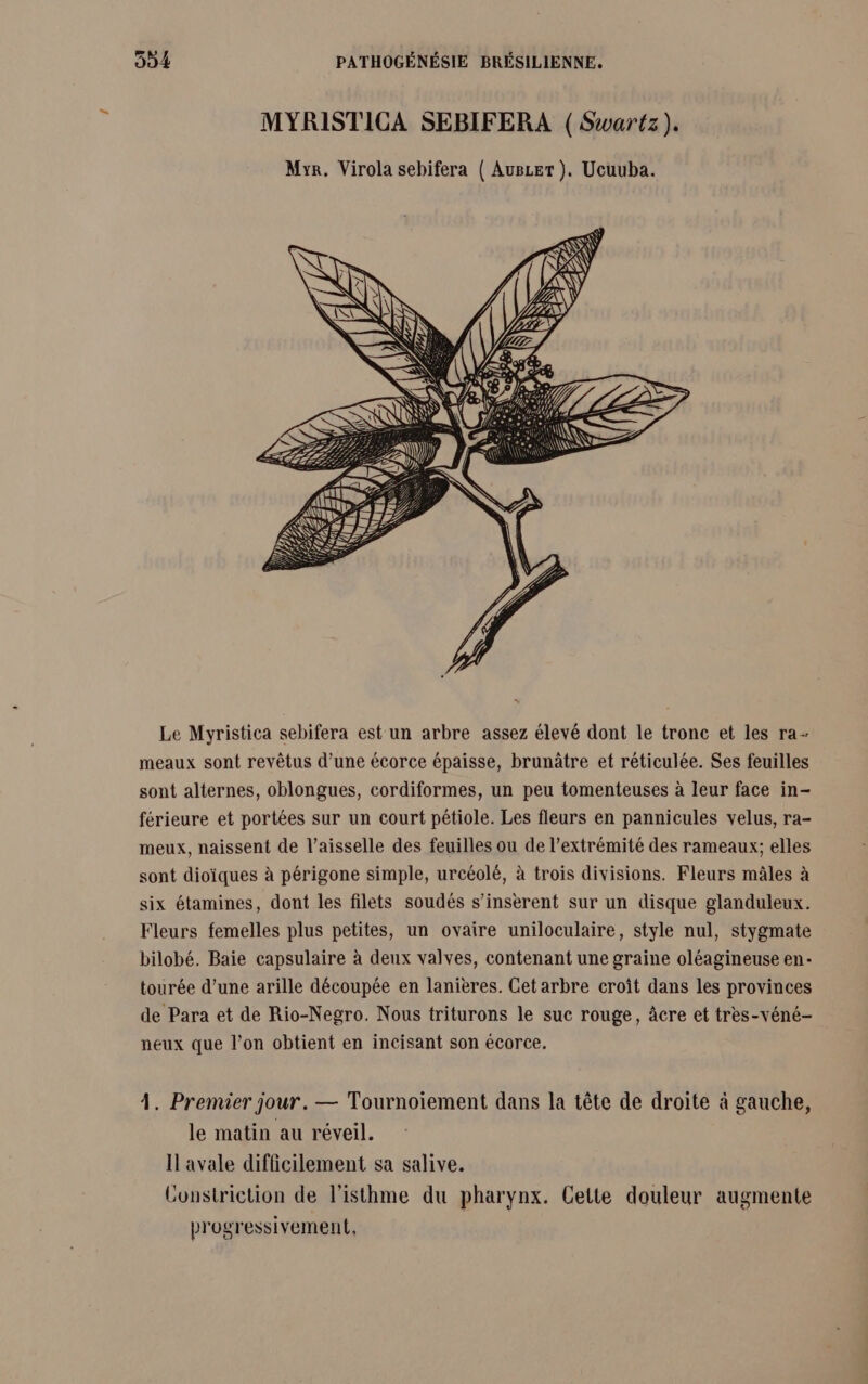 Le Myristica sebifera est un arbre assez élevé dont le tronc et les ra- meaux sont revêtus d’une écorce épaisse, brunâtre et réticulée. Ses feuilles sont alternes, oblongues, cordiformes, un peu tomenteuses à leur face in- férieure et portées sur un court pétiole. Les fleurs en pannicules velus, ra- meux, naissent de l’aisselle des feuilles ou de l’extrémité des rameaux; elles sont dioïques à périgone simple, urcéolé, à trois divisions. Fleurs mâles à six étamines, dont les filets soudés s’inserent sur un disque glanduleux. Fleurs femelles plus petites, un ovaire uniloculaire, style nul, stygmate bilobé. Baie capsulaire à deux valves, contenant une graine oléagineuse en- tourée d’une arille découpée en lanières. Cet arbre croît dans les provinces de Para et de Rio-Negro. Nous triturons le suc rouge, âcre et tres-véné- neux que l’on obtient en incisant son écorce. 4. Premier jour. — Tournoiement dans la tête de droite à gauche, le matin au réveil. Il avale difficilement sa salive. Constriction de l’isthme du pharynx. Cette douleur augmente progressivement,