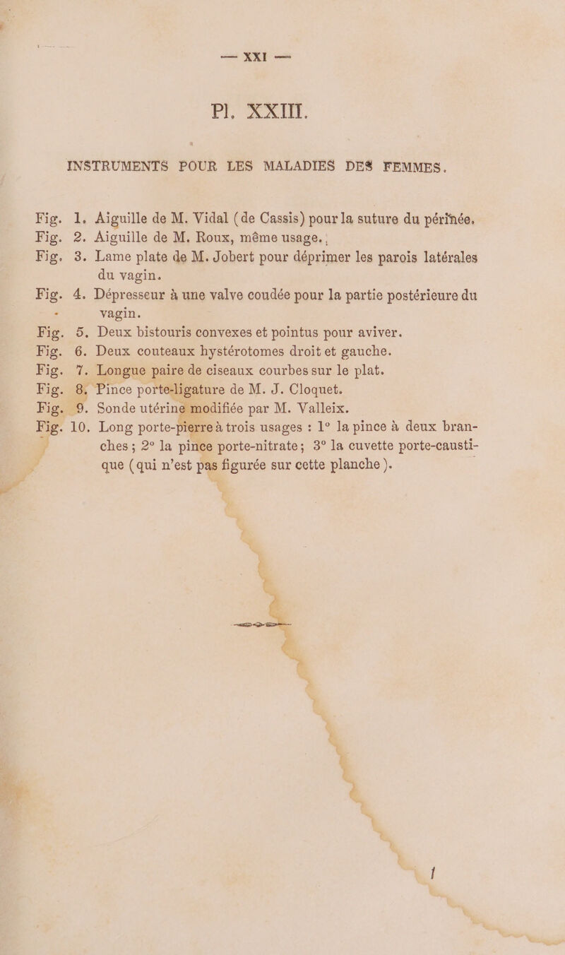 RAT PRO. Fig, 2. Fig. 3. Fig. 4. Fig. 5. Fig. 6. Fig. 1e Fig. 8. Aiguille de M. Roux, même usage. , Lame plate de M. Jobert pour déprimer les paroïs latérales du vagin. Dépresseur à une valve coudée pour la partie postérieure du vagin. Deux bistouris convexes et pointus pour aviver. Deux couteaux hystérotomes droit et gauche. Longue paire de ciseaux courbes sur le plat. Pince porte-ligature de M. J. Cloquet. Sonde utérine modifiée par M. Valleix. ere à trois usages : 1° la pince à deux bran- ches ; 2° la pince porte-nitrate; 3° la cuvette porte-causti- que (qui n’est pas figurée sur cette planche ). =