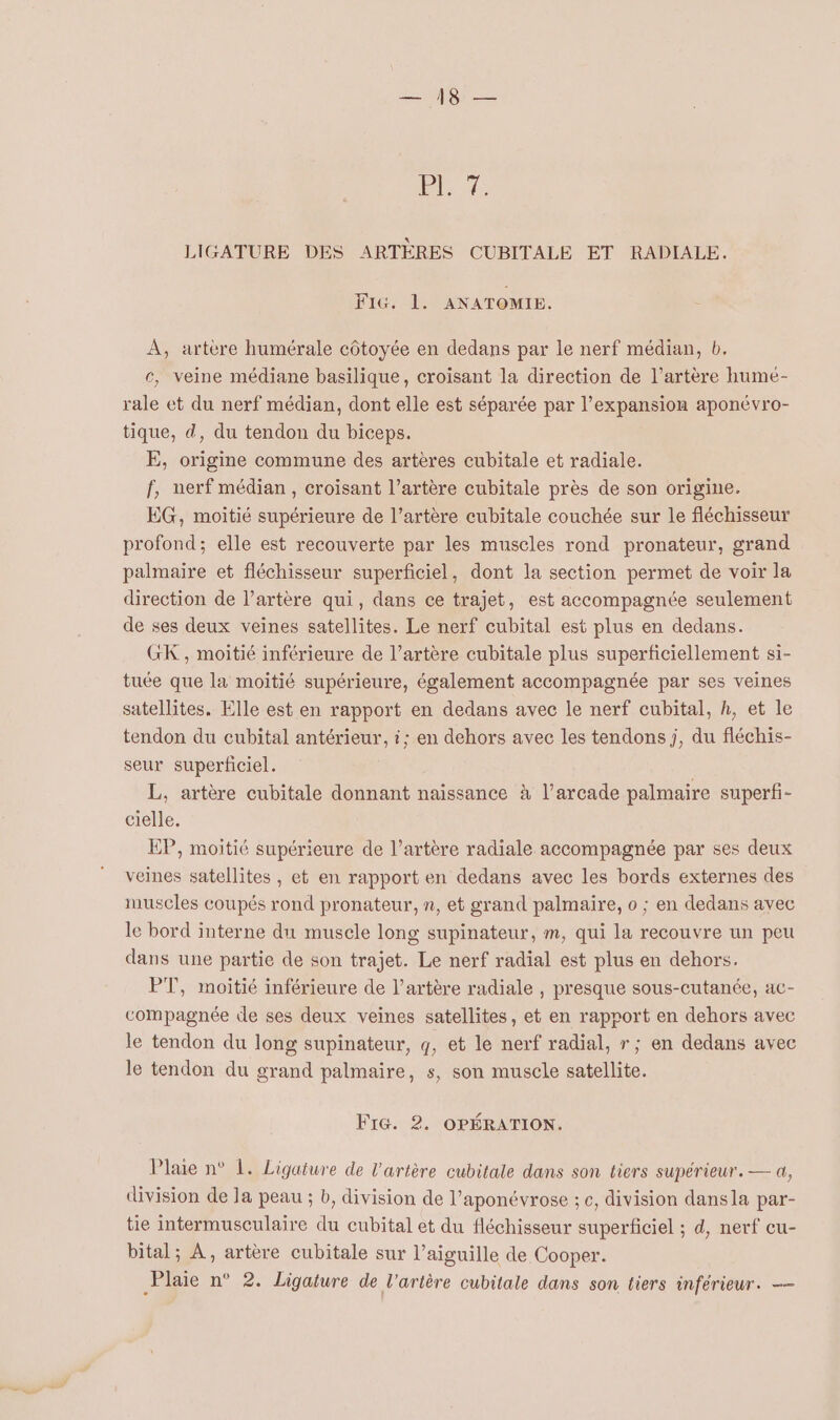 Te El LIGATURE DES ARTÈRES CUBITALE ET RADIALE. FIG. 1. ANATOMIE. e À, artère humérale côtoyée en dedans par le nerf médian, b. c, veine médiane basilique, croïsant la direction de l’artère hume- rale et du nerf médian, dont elle est séparée par l’expansion aponévro- tique, d, du tendon du biceps. E, origine commune des artères cubitale et radiale. f, nerf médian, croisant l’artère cubitale près de son origine. EG, moitié supérieure de l’artère cubitale couchée sur le fléchisseur profond; elle est recouverte par les muscles rond pronateur, grand palmaire et fléchisseur superficiel, dont la section permet de voir la direction de l’artère qui, dans ce trajet, est accompagnée seulement de ses deux veines satellites. Le nerf cubital est plus en dedans. GK, moitié inférieure de l’artère cubitale plus superficiellement si- tuée que la moitié supérieure, également accompagnée par ses veines satellites. Elle est en rapport en dedans avec le nerf cubital, h, et le tendon du cubital antérieur, i; en dehors avec les tendons j, du fléchis- seur superficiel. L, artère cubitale donnant naissance à l’arcade palmaire superfi- cielle. EP, moitié supérieure de l’artère radiale accompagnée par ses deux veines satellites , et en rapport en dedans avec les bords externes des muscles coupés rond pronateur, n, et grand palmaire, o ; en dedans avec le bord interne du muscle long supinateur, m, qui la recouvre un peu dans une partie de son trajet. Le nerf radial est plus en dehors. PT, moitié inférieure de l’artère radiale , presque sous-cutanée, ac- compagnée de ses deux veines satellites, et en rapport en dehors avec le tendon du long supinateur, q, et le nerf radial, »; en dedans avec le tendon du grand palmaire, s, son muscle satellite. FIG. 2. OPÉRATION. Plaie n° 1. Ligature de l'artère cubitale dans son tiers supérieur. — a, division de la peau ; b, division de l’aponévrose ; c, division dansla par- tie intermusculaire du cubital et du fléchisseur superficiel ; d, nerf cu- bital; À, artère cubitale sur l'aiguille de Cooper. Plaie n° 2. Ligature de l'artère cubitale dans son tiers inférieur. ——