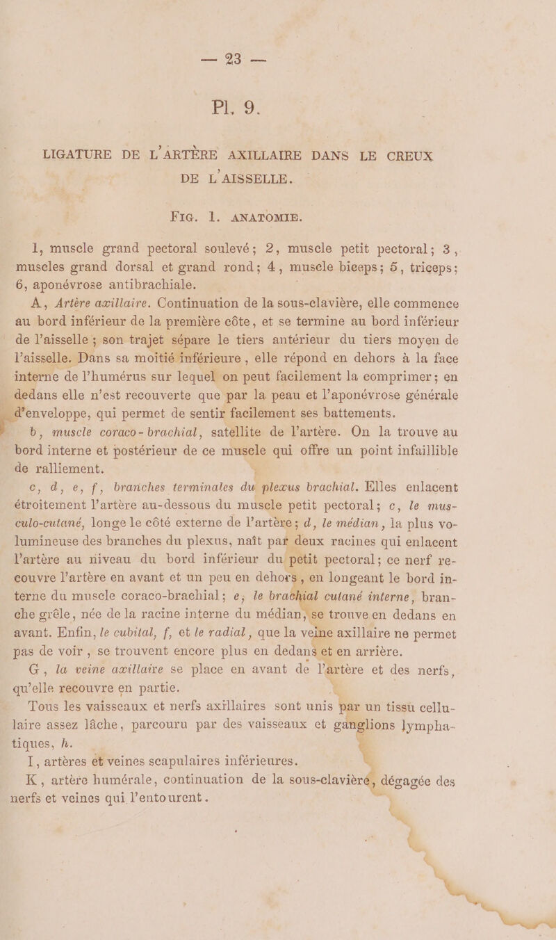 do Li 5 À LIGATURE DE L'ARTÈRE AXILLAIRE DANS LE CREUX DE L AISSELLE. FIG. 1. ANATOMIE. 1, muscle grand pectoral soulevé; 2, muscle petit pectoral; 3, museles grand dorsal et grand rond; 4, F. biceps ; 5, triceps: 6, aponévrose antibrachiale. À, Artère axillaire. Continuation de la sous-clavière, elle commence au bord inférieur de la première côte, et se termine au bord inférieur _ de l’aisselle ; son trajet sépare le tiers antérieur du tiers moyen de l’aisselle. Dans sa moitié inférieure , elle répond en dehors à la face interne de l’humérus sur lequel on peut facilement la comprimer; en D elle n’est recouverte que par la peau et l’aponévrose générale ….d’enveloppe, qui permet de sentir facilement ses battements. b, muscle coraco-brachial, satellite de l’artère. On la trouve au Era interne et postérieur de ce musele qui offre un point infaillible de ralliement. 1 c, d,e,f, branches terminales dur pleæus brachial. Elles enlacent étroitement l’artère au-dessous du musele petit pectoral; c, le mus- culo-cutané, longe le côté externe de l'artère ; d, le médian, la plus vo- lumineuse des branches du plexus, naît par « box racines qui enlacent l’artère au niveau du bord inférieur du petit pectoral; ce nerf re- couvre l’artère en avant et un peu en dehors, en longeant le bord in- terne du muscle coraco-brachial; e; le brachial cutané interne, bran- che grêle, née de la racine interne du médian,'se trouve en dedans en avant. Enfin, le cubital, f, et le radial, que la veine axillaire ne permet pas de voir , se trouvent encore plus en dedans et en arrière. G, la veine aæillaixe se place en avant de l'artère et des nerfs, qu’elle recouvre en partie. À Tous les vaisseaux et nerfs axïllaires sont unis 2 un tissu cellu- laire assez lâche, parcouru par des vaisseaux et g ions Jympha- tiques, h. I, artères et veines scapulaires inférieures. K , artère humérale, continuation de la sous-clavièré,, dégagée des nerfs et veines qui l’entourent.