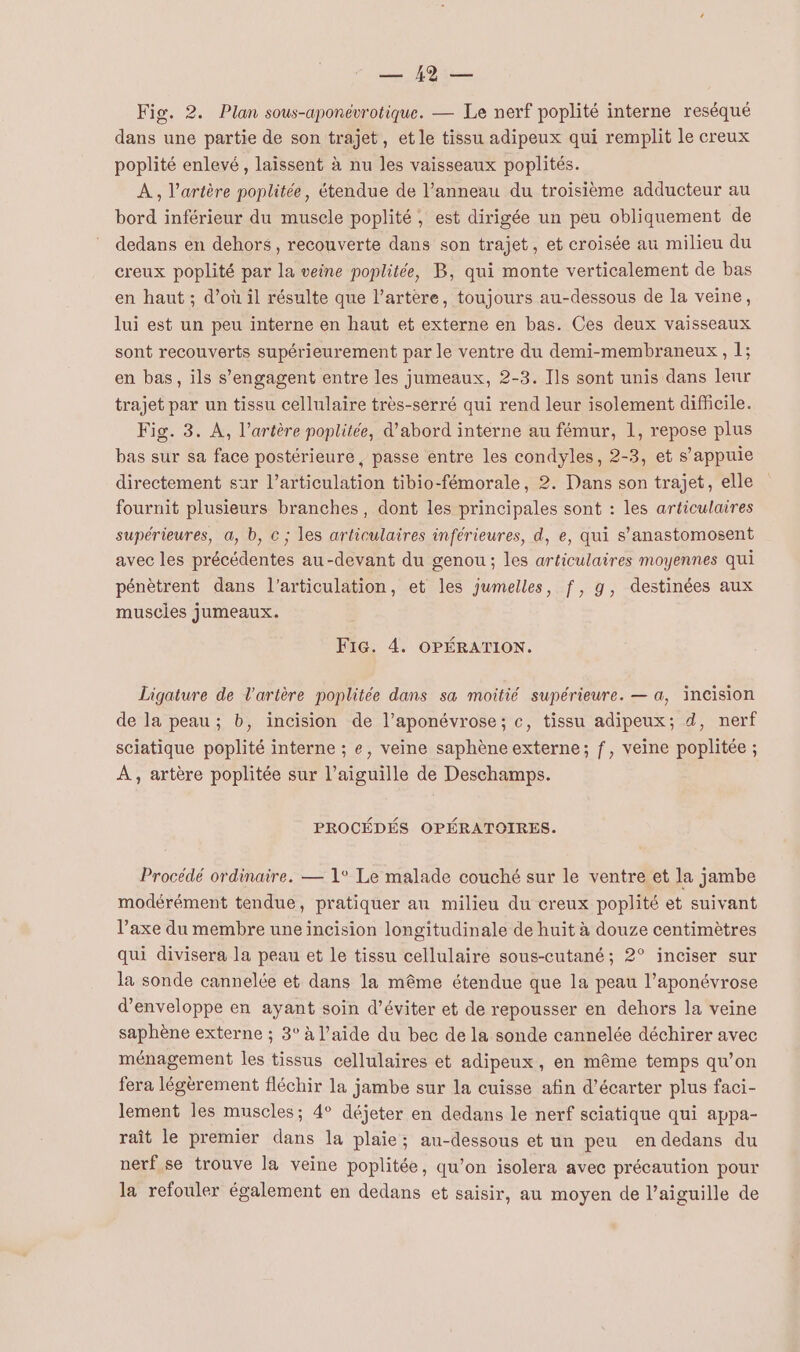 AO Fig. 2. Plan sous-aponévrotique. — Le nerf poplité interne reséqué dans une partie de son trajet, et le tissu adipeux qui remplit le creux poplité enlevé, laissent à nu les vaisseaux poplités. À, l'artère poplitée, étendue de l’anneau du troisième adducteur au bord inférieur du muscle poplité , est dirigée un peu obliquement de dedans en dehors, recouverte dans son trajet, et croisée au milieu du creux poplité par la veine poplitée, B, qui monte verticalement de bas en haut ; d’où il résulte que l’artère, toujours au-dessous de la veine, lui est un peu interne en haut et externe en bas. Ces deux vaisseaux sont recouverts supérieurement par le ventre du demi-membraneux, 1; en bas, ils s'engagent entre les jumeaux, 2-3. Ils sont unis dans leur trajet par un tissu cellulaire très-serré qui rend leur isolement difficile. Fig. 3. À, l'artère poplitée, d'abord interne au fémur, l, repose plus bas sur sa face postérieure, passe entre les condyles, 2-3, et s'appuie directement sur l’articulation tibio-fémorale, 2. Dans son trajet, elle fournit plusieurs branches, dont les principales sont : les articulaires supérieures, a, b, c ; les articulaires inférieures, d, e, qui s’anastomosent avec les précédentes au-devant du genou; les articulaires moyennes qui pénètrent dans l'articulation, et les jumelles, f, g, destinées aux muscies jumeaux. F1G. 4. OPÉRATION. Ligature de l'artère poplitée dans sa moitié supérieure. — a, incision de la peau ; b, incision de l’aponévrose; c, tissu adipeux; d, nerf sciatique poplité interne ; e, veine saphène externe; f, veine poplitée ; À, artère poplitée sur l’aiguille de Deschamps. PROCÉDÉS OPÉRATOIRES. Procédé ordinaire. — 1° Le malade couché sur le ventre et la jambe modérément tendue, pratiquer au milieu du creux poplité et suivant l’axe du membre uneincision longitudinale de huit à douze centimètres qui divisera la peau et le tissu cellulaire sous-cutané; 2° inciser sur la sonde cannelée et dans la même étendue que la peau l’aponévrose d’enveloppe en ayant soin d'éviter et de repousser en dehors la veine saphène externe ; 3° à l’aide du bec de la sonde cannelée déchirer avec ménagement les tissus cellulaires et adipeux, en même temps qu’on fera légèrement fléchir la jambe sur la cuisse afin d’écarter plus faci- lement les muscles; 4° déjeter en dedans le nerf sciatique qui appa- raît le premier dans la plaie; au-dessous et un peu en dedans du nerf se trouve la veine poplitée, qu’on isolera avec précaution pour la refouler également en dedans et saisir, au moyen de l’aiguille de