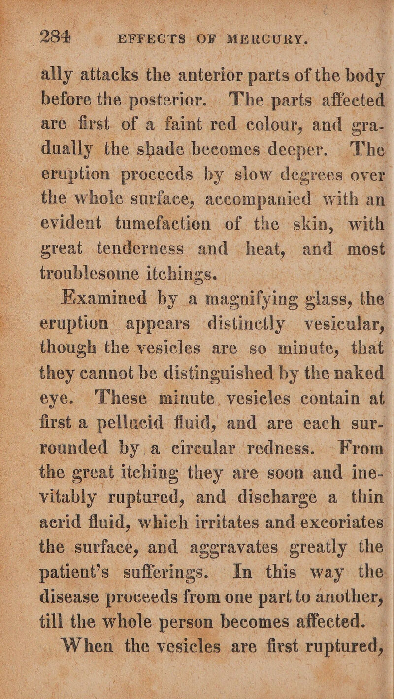 vy | Saad ~ Se great tenderness and heat, and most troublesome itchings. Examined by a magnifying glass, the eruption appears distinctly vesicular, though the vesicles are so minute, that eye. ‘These minute, vesicles contain at acrid fluid, which irritates and excoriates disease proceeds from one part to another, till the whole person becomes affected. — When the vesicles are first ruptured,