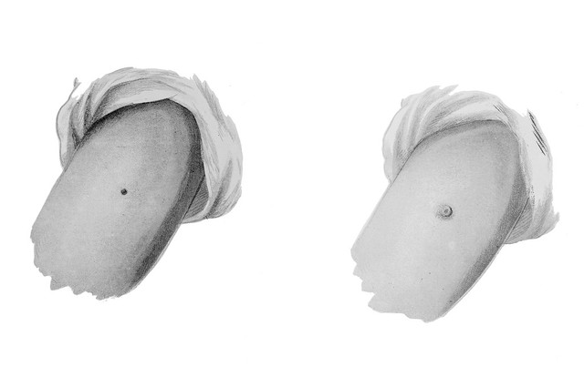 digitised image 1