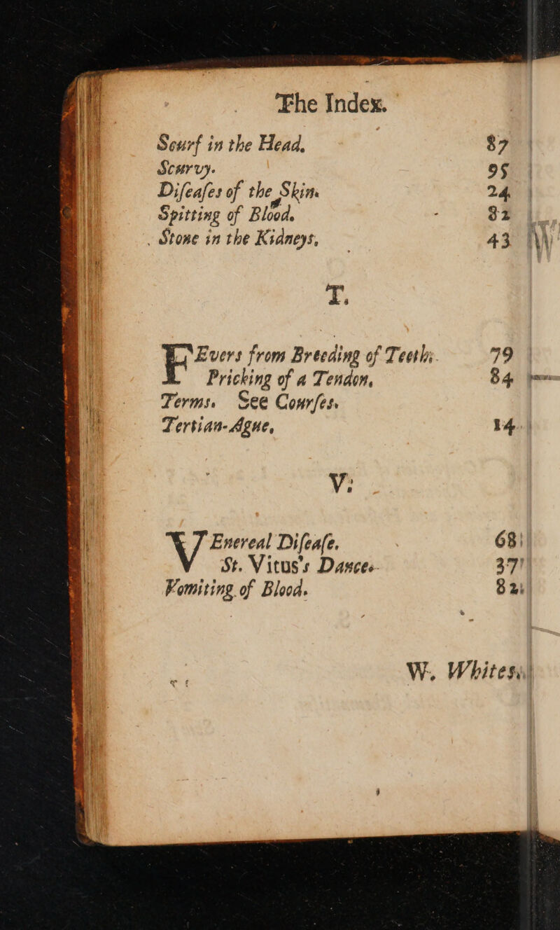 Who : TOP emm The Index. Seurf in the Head, $7 Scurvy. 95 Difeafes of the Skin. 24. Spitting of Blood. 32 . Stone in the Kidneys, — 43° Thi I. Evers from Br ecding of Teeth; 79 Pricking of a Tendon, 84 m | Terms. See Confer, i Tertian- gue, 14.) u V; d | Enereal Difeafe. 68; B St. Vitus's Dascee- 37) Vomiting of Blood. 82. W. Whites’