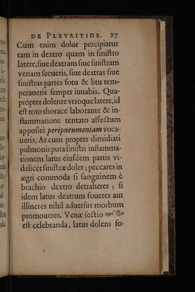 Cum enim dolor percipiatur tam in dextro quam in finiftro latete;fiue dextram fiue fimftram venam fecueris, fiue dextras fiue finiftras partes fotu &amp; litu cem- peraueris femper iuuabis. Qua- propter dolente vtroquelatere,id eft totothorace laborante &amp; 1n- flammatione tentato affectum appofité perzpneumoniam voca- ueris, Át cum propter dimidiati pulmonis puta finifti inflamma- tionem latus eiufdem partis vi- delicet finiftra dolet ; peccaresin xoti commoda fi fanguinem é brachio dextro detraheres ; fi idem latus. dextrum foueres aut illineres nihil aduerfus morbum promoueres. Ven (e&amp;tio x e eft celebranda, latus dolens fo-