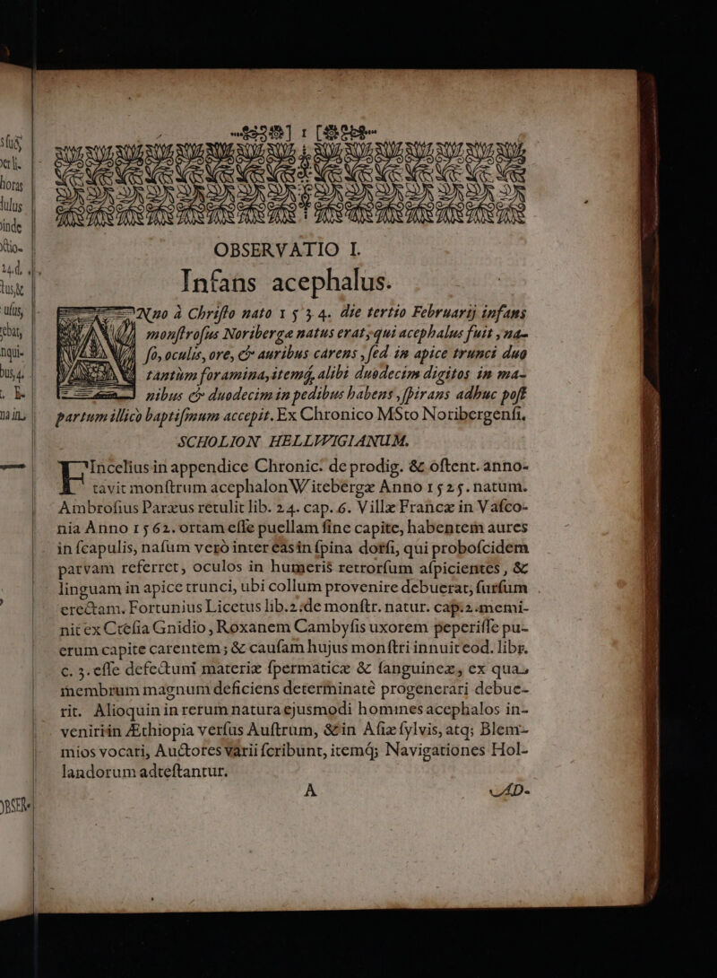 Bu DEUM OBSERVATIO I. Infans acephalus. Nw à Chriffo nato 1 53.4. die tertio Februari) infams mpouftro[us Noriberge natus eratyqui 'actphalus fuit ,2a- | fo oculis, ore, € auribus. cArens ,fed. im apice trunci duo tantum forAminayi item, f alibi duedecim digitos in ma- nibus ci duodecim in pedibus babens ,ffirans adhuc poft E illic) baptifmum accepit. Ex Chronico MSto Noire i i SCHOLION HELLYIIGIANUM. Incelius in appendice Chronic: de prodig. &amp; oftent. anno- tavit mon(trum acephalonW/itebergx Anno 1 525.natum. Ambrofius Parxus rexulit lib. 24. cap..6. Ville Francx in Vafco- nia Ànno 15 62. ortam efle puellam fine capite, habentem aures in fcapulis, nafum veró inter easin fpina dorfi, qui probofcidem parvam referret, oculos in humeris retrorfum afpicientes , &amp; linguam in apice trunci, ubi collum provenire debuerat; furfum etéckar . Fortunius Licetus lib.2:de monítr. natur. cap.2.memi- nit ex Ctefia Gnidio , Roxanem Cambyfis uxorem peperiffe pu- erum capite carentem; &amp; caufam hujus monftri innuit eod. libr. c. 3. effe defe&amp;uni materi fpermatice &amp; fanguinez, ex qua, pr um magnum deficiens determinate progenerari debue- t. Alioquin i in rerum natura ejusmodi homines acephalos in- veniriin Zxhiopia verfus Auftrum, &amp;in Afix íylvis, atq; Blem- mios vocari, Auctores varii fcribunt, iemd; Navigationes Hol- landorum adteftantur. A vAD-