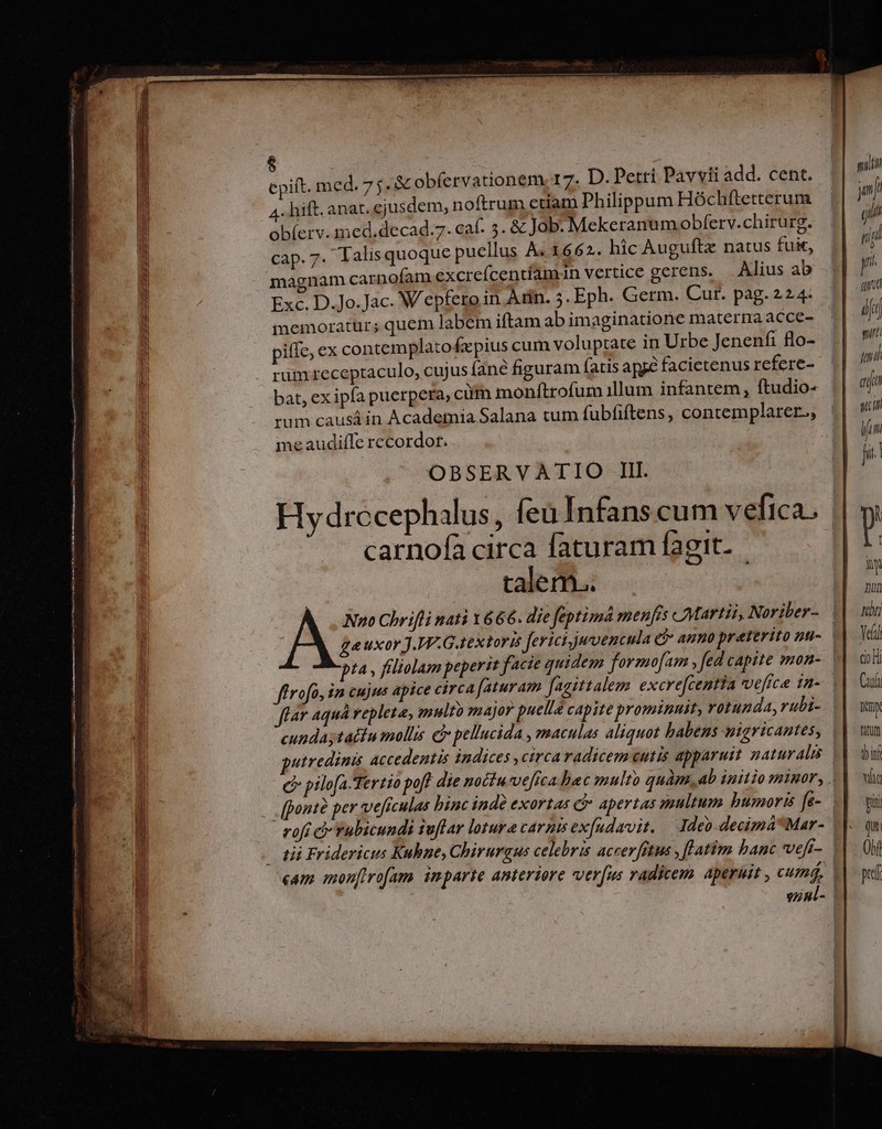 —————————— $ ! 4. hift. anat. ejusdem, noftrum ctiam Philippum Hóchftetterum obíerv. med.decad.7. caf. 5. &amp; Job. Mckeranum obferv.chirurg. cap. 7- Talis quoque puellus A. 1662. hic Augufte natus fuit, magnam carnofam excrefcenciamin vertice gerens. Alius ab Exc. D.Jo.Jac. Wepfero in Atin. 5. Eph. Germ. Cur. pag. 224. memoratur; quem labem iftam ab imaginatione materna acce- piffe, ex contemplato (icpius cum voluptate in Urbe Jenenfi flo- rum receptaculo, cujus fané figuram (atis ape facietenus refere- bat, ex ipfa puerpera, ci monítrofum illum infantem, ftudio- rum causá in Academia Salana tum fubfiftens, contemplarer., | meaudiffe recordor. | OBSERVATIO III. Hydrocephalus, feu Infans cum vefica. carnofa circa faturam fagit- talem.. Nno Chrifli nati 1666. die feptim menfis Martis, Noriber- gauxar J.VP.G.textoris fericiumvencula e) anmo preterito nu- | pta , filiolam peperit facie quidem formofam y fed capite »mon- ffrofa, im cujus apice circa faturam Jagittalem excre[centta vefice tn- flar aqua repleta, multo major puella capite prominuit, rotunda,rubi- cundáytacín molis e pellucida maculas aliquot babens yigricantes, utredinis Accedentis indices , circa radicem eutis apparuit zatur Alas (e pilo[a-Tertio pofl die noctu vefica bac multo quàm, ab initio minor, , [ponté per veficulas binc indé exortas c apertas multum humoris [e- rofi d Yubicundi suflar lotura carnisex[udavit. — Ideo. decimá*Mar- «am monfirofam. imparte anteriore verfus radicem. aperuit , cum, vinl-