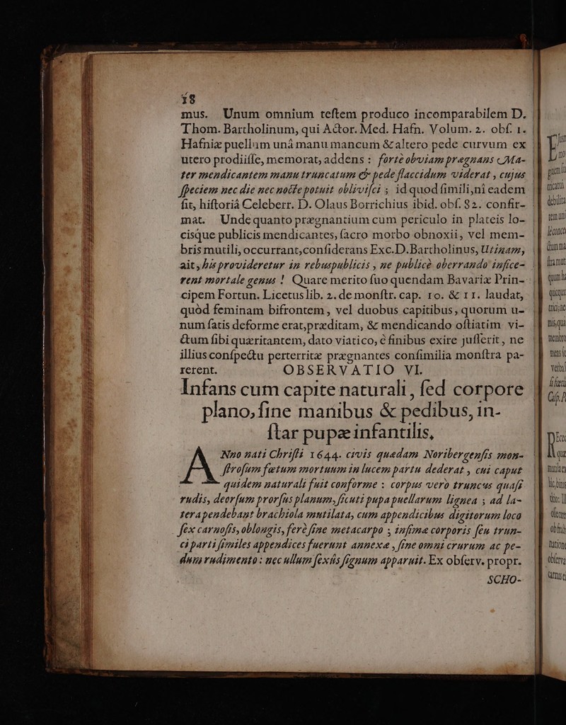 4 18 mus. Unum omnium teftem produco incomparabilem D. | Thom. Bartholinum, qui Acor. Med. Hafn. Volum. 2. obf. 1. | Hafnix puellam unà manu mancum &amp;altero pede curvum ex utero prodiiffe, memorat, addens : forte obviam pregnans «Ma- : ter mendicantem manu truncatum ef pede flaccidum viderat , cujus : pan fpeciem nec die nec notfe potuit oblivifci ; id quodfimiliyjnieadem |] ' fit, hiftoriá Celeberr. D. Olaus Borrichius ibid. obf, 82. confir- || 6? mat. Undcquanto prezgnantium cum periculo in plateis lo- || 9 cisque publicis mendicantes, facro morbo obnoxii, vel mem- || ? bris mutili,occurrant,confiderans Exc.D.Bartholinus, Uz/z477, || unm ait; Ju provideretur ip rebuspublicis , ue publicé oberrando iufrce-. framit rent mortale genus ! Quare merito fuo quendam Bavarix Prin- qun cipem Fortun. Licetuslib. 2. de monftr. cap. 1o. &amp; 11. laudat, |] 0 quód feminam bifrontem , vel duobus capitibus, quorum u- |] t num fatis deforme erat;przditam, &amp; mendicando oftiatim vi- nisqu &amp;um fibi quzritantem, dato viatico, à finibus exire juflerit, ne. |] um illius confpe&amp;u perterritx przgnantes confimilia monítra pa- |f 9 rcrent. OBSERVATIO VI. Ye Infans cum capite naturali, fed corpore || z ; TP , Gf./ plano.fine manibus &amp; pedibus, in- ftar pupa infantilis, I n A No nati Chrifli 1644. civis quedam Noriberzenfis zmos-. | Wu fhrofum fetum mortuum in lucem partu dederat , cui caput |j muto : quidem naturali fuit conforme s corpus vero truncus quafi. ||| tus rudis, deorfum prorfus plamum. ficuti pupa puellarum lignea s 4d la-. |] tio: ] zerapendebant bracbiola mutilata, cum appendicibus digitorum loca M vs fex caruoffs, oblongis, ferà fine metacarpo ; infima corporis [éu trun-. M ttt ci parti fimiles appendices fuerunt annexa , [fne omni crurum ac pe- Tation dun rudimento : uec ullum fexás fguum apparuit. Ex obferv. propr. || ti; SCHO- | DISC