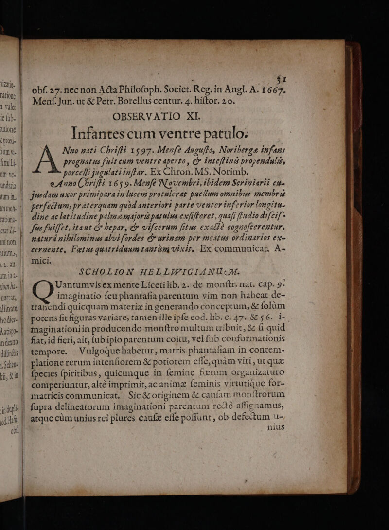 'aC]0f) 2 je fub tution um y um vc wdirio | C M | I hodie Atisp y che kii, V 1 [f Wi e| 0| LI ] - ine 3; NI obf. 27. nec non Ata Philofoph. Societ. Reg. in Angl. A. 1667. Menf. Jun. ut &amp; Petr. Borellus centur. 4. hiftor. 26. OBSERVATIO XI. Infantes cum ventre patulo. Nno nati Chrifli 1597. Menfe Auguflo, Noriberge infans proguatus fuit cum ventre aperto, dr inteflHinis propendalis, porcelti jugulati inftar. Ex Chron. MS. Norimb. e/dono Chrifli Y65 9. Menfe Novembri, ibidem Scriniarii cu- jusdam uxor primipara iz lucem protulerat pueum omnibus imnembr ie perfectum, pr aterquam quód anteriort parte veuter inferior longitu. dine ac latitudine palma majoris patulus exfifferet, quaft [Hudio difecif- fe fuiffet, itat C hepar, e vifcerum fftus exadie eognofcerentar, naturá nibilominu alvifordes d urinam per meatus ordinarios ex- cernente, Fetus quatriduum tautum vixit, Ex communicat. A- mici. SCHOLION HELLIVIGIANU«qkf. Uantumvis ex mente Licetilib. 2. de monftr. nat. cap. 9. imaginatio Íeu phantafia parentum vim non habeat de- trabendi quicquam materix in generando conceptum, &amp; folàüm potens fit figuras variare, tamen ille ipfe eod. hb. c. 47. 8 56. i-. maginationiin producendo monftro multum tribuit, &amp; fi quid fiat, id fieri, ait, (ub iplo parentum coitu, vel fab conforinationis tempore. | Vulgoque habctur , matris phan:afiamn in contem- platione rerum intenfiorem &amp; potiorem cfle, quàm viri , ut qux fpecies fpiritibus, quicunque in femine foetum organizaturo comperiuntur, alté imprimit, ac animz feminis virtutique for- matricis communicat, Sic&amp; originem &amp; caufam monílrorum fupra delineatorum imaginationi parencum rede affignamus, atque cüm unius rei plures eaufz eile poffunt, ob defectum u- nius