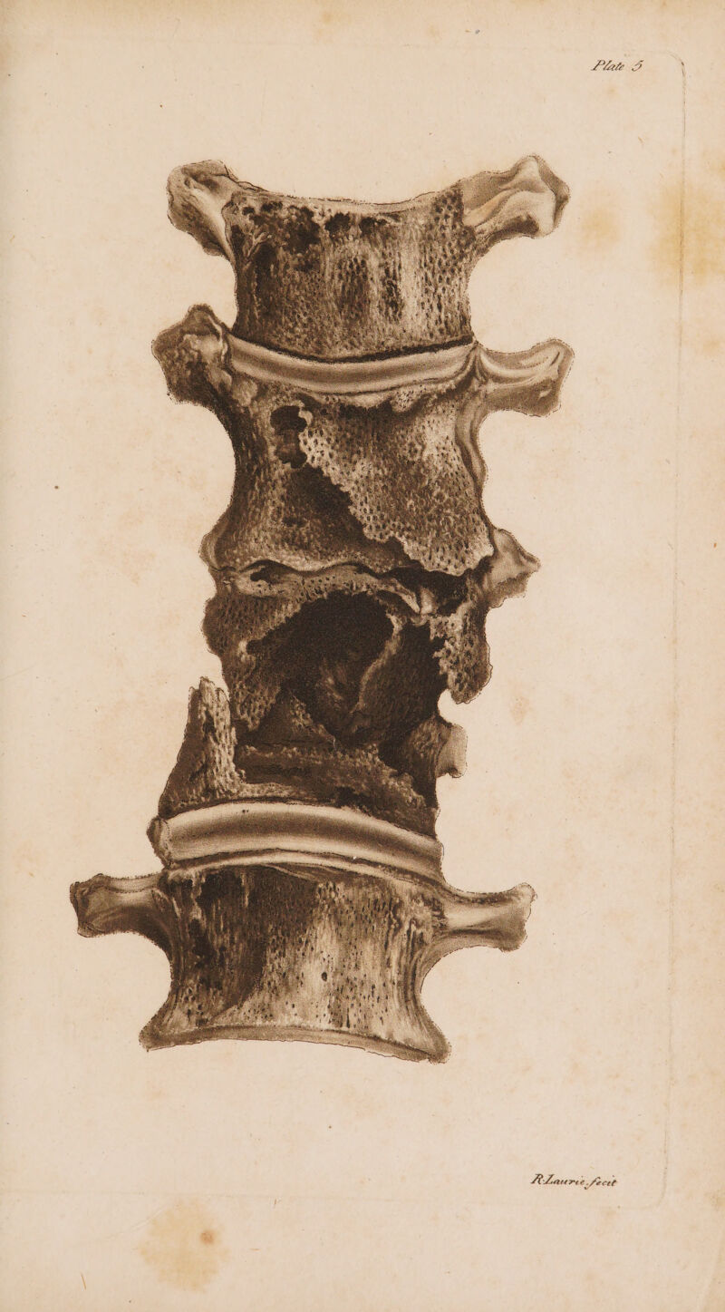 Llate FP RLaurn e.fecet