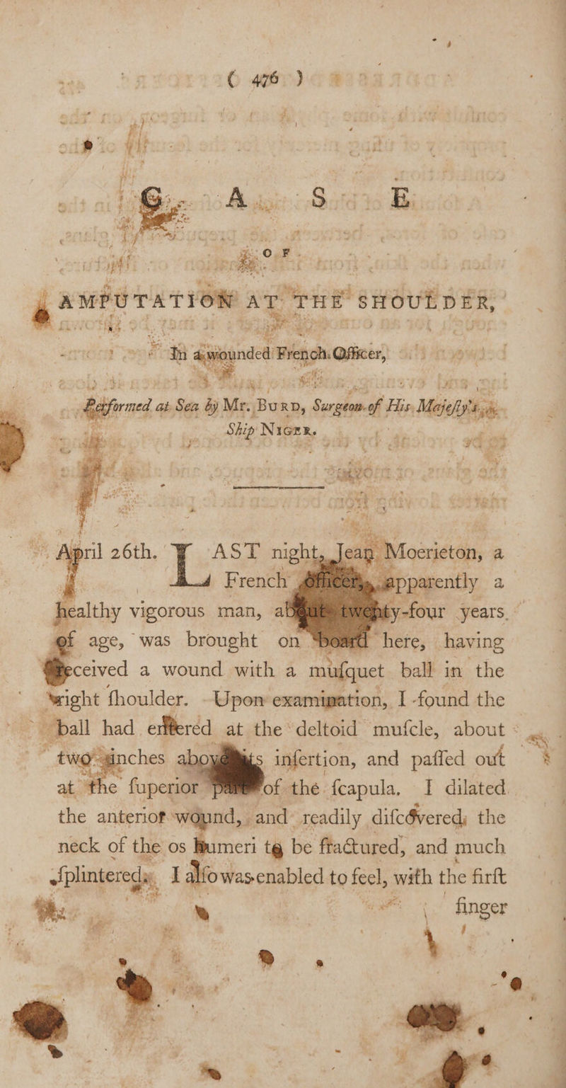 a °. F. a AMPUTATION AT THE “sHout ER, ; ' ee ue &gt; if ce ey i : = i iu se: naa Si? ey om: ; jai ans | Aired at Sea by Mr. Bu RD, Surgeon of His Ma Ship NIGER. | ? E rench healthy vigorous man, abj &gt; gf age, was brought on “Beard “here, having ceived a wound with a mufquet ball in the ‘wight fhoulder. -Upon examipation, I -found the pall had eaflered. at the deltoid mufcle, about . : tuggipches | infertion, and paffed out at ‘the faperior “‘pam@rof the fcapula, I dilated the anteriof wound, and Teadily, difcOvered, the neck of the os Bumeri tg be fractured, and much