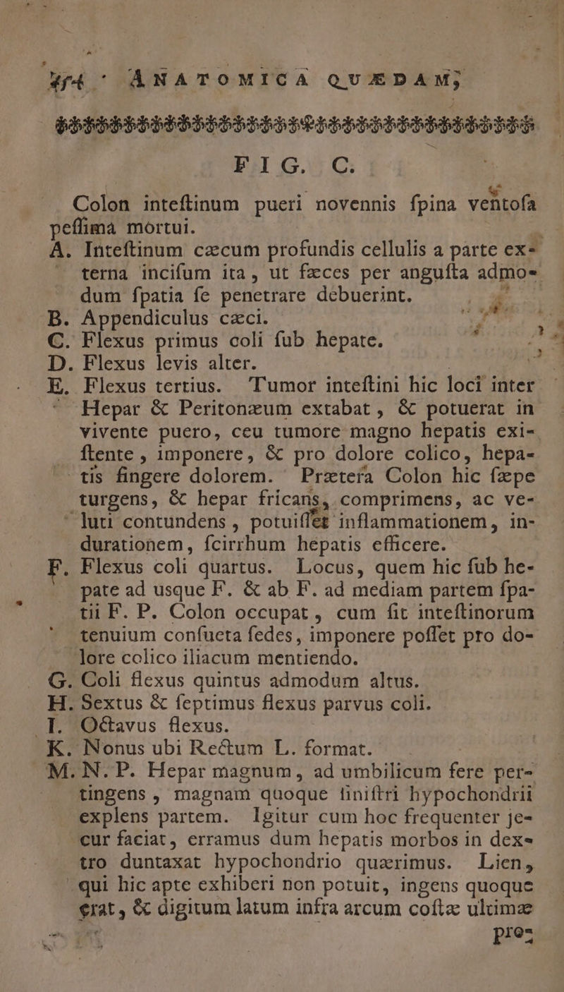 bc ANATOMICA QUEDAM; bb3EbbbPRbPBPBRPO PRDPPPRRBBPRbDiPh FIG. C. Colon inteftinum pueri novennis fpina ventofa peffima mortui. A. Inteftinum czcum profundis cellulis a parte ex- terna incifum ita, ut fzces per anguíta admo- dum fpatia fe penetrare debuerint. Hs .B. Appendiculus czci. S xu C. Flexus primus coli fub hepate. x D. Flexus levis alter. : E. Flexus tertius. umor inteftini hic loci inter ^ Hepar & Peritonzum extabat , & potuerat in vivente puero, ceu tumore magno hepatis exi- ftente , imponere, & pro dolore colico, hepa- -. tis fingere dolorem. ^ Prztera Colon hic fzpe turgens, & hepar fricans, comprimens, ac ve- ' luu contundens , potuiffeg inflammationem, in- durationem, fcirrhum hepatis efficere. . Flexus coli quartus. Locus, quem hic fub he- pate ad usque F. & ab F'. ad mediam partem fpa- tii F. P. Colon occupat , cum fit inteflinorum tenuium confuceta fedes , imponere poffet pro do- lore colico iliacum mentiendo. G. Coli flexus quintus admodum altus. H. Sextus & feptimus flexus parvus coli. .I. Octavus flexus. K. Nonus ubi Rectum L. format. M. N. P. Hepar magnum, ad umbilicum fere per- tingens , magnam quoque finiftri hypochondrii explens partem. lgitur cum hoc frequenter je- cur faciat, erramus dum hepatis morbos in dex- tro duntaxat hypochondrio quarimus. Lien, .qui hic apte exhiberi non potuit, ingens quoque €rat , & digitum latum infra arcum coftac ultimae eu | pre
