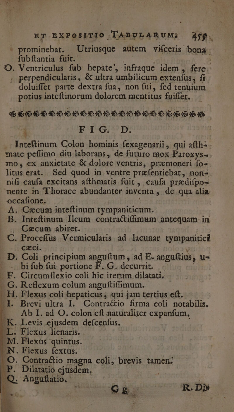 l ET EXPOSITIO TABULARUM; 4f. P 1 t j Bu Ww 0 ES € gn , 4.9 * prominebat. Utriusque autem viíceris bona fubítantia fuit. Oii - O. Ventriculus fub hepate', infraque idem , fere. perpendicularis, &amp; ultra umbilicum extenfus, fi. doluiffet parte dextra fua, non fui, fed tenuium potius inteftinorum dolorem mentitus fuiffet. 36 36 0646 46 46 16 46 i16 16 16 1636 46 1036 4610 I6 6 46 16 b 4 E FIG. D. Intettinum Colon hominis fexagenarii, qui afth- mate peffimo diu laborans, de futuro mox Paroxys- . mo, ex anxietate &amp; dolore ventris, przmoneri fo- litus erat. Sed quod in ventre praíentiebat, non- nifi caufa excitans afthmatis fuit , caufa przdifpo- nente in Thorace abundanter inventa , de qua alia occafione. | | A. Czcum inteftinum tympaniticum. B. Inteftinum Ileum contractifimum antequam. in . Czcum abiret. | C. Proceffus Vermicularis ad lacunar tympaniticf czci. eui .. D. Coli principium anguítum , ad E. anguftius, u- - «. bifub fui portione F, G. decurrit. . F. Circumflexio coli hic iterum dilatati. -. G. Reflexum colum anguftiffimum. | -. H. Flexus coli hepaticus, qui jam tertius eft. .l1. Brevi ultra I. Contractio firma coli notabilis. - . AbI. ad O. colon eft naturalizer expanfum. .K.. Levis ejusdem defceníus. L. Flexus lienaris. .M. Flexus quintus. .N. Flexus fextus. .O. Contra&amp;io magna coli, brevis tamen: -P. Dilatatio ejusdem. . Anguftatio. | iy * xem Por d Mie c.