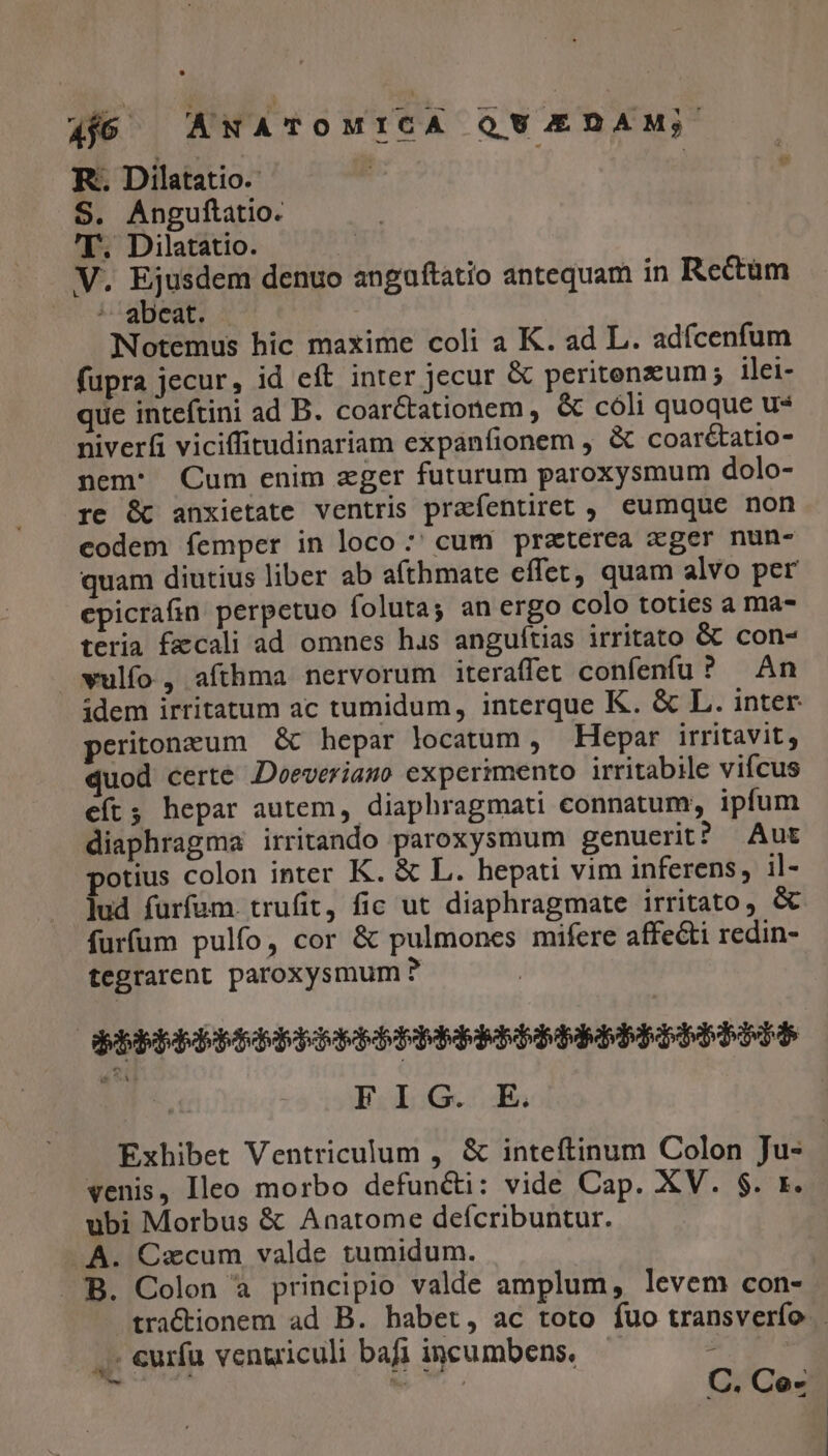 4jó | ANATOMICA QVU/£DAM; R.. Dilatatio. | ; S. Anguftatio. T. Dilatatio. V. Ejusdem denuo anguftatio antequam in Rectum *0- 4igbean Notemus bic maxime coli a K. ad L. adfcenfum fupra jecur, id eft inter jecur &amp; peritenzum; ilei- que inteftini ad B. coarctationem , &amp; cóli quoque us niverfi viciffitudinariam expanfionem , &amp; coar&amp;tatio- nem: Cum enim zger futurum paroxysmum dolo- re &amp; anxietate ventris prafentiret ,. eumque non codem femper in loco *' cum praterea cger nun- quam diutius liber ab afthmate effet, quam alvo per epicrain perpetuo foluta; an ergo colo toties a ma- teria fecali ad omnes hus anguítias irritato Gt con- wulfo, afthma nervorum iteraffet confenfu? An idem irritatum ac tumidum, interque K. &amp; L. inter peritonzum | &amp; hepar locatum , Hepar irritavit, quod certe Deeveriamo experimento irritabile vifcus eft; hepar autem, diaphragmati connatum, ipfum diaphragma irritando paroxysmum genuerit? Aut potius colon inter K. &amp; L. hepati vim inferens, il- lud furfam. trufit, fic ut diaphragmate irritato, &amp; furfum pulfo, cor &amp; pulmones mifere affecti redin- tegrarent paroxysmum ? OBDEBDPEEESOEEEPPEEEBBBEREDEEBINKIE ii Eau 6 d Exhibet Ventriculum , &amp; inteftinum Colon Ju- venis, Ileo morbo defun&amp;i: vide Cap. XV. $. 1. ubi Morbus &amp; Anatome defcribuntur. A. Czcum valde tumidum. B. Colon à principio valde amplum, levem con- traCctionem ad B. habet, ac toto fuo transverfo . . €urfu venuiculi bafi incumbens, — ES - ^ C. Ce-