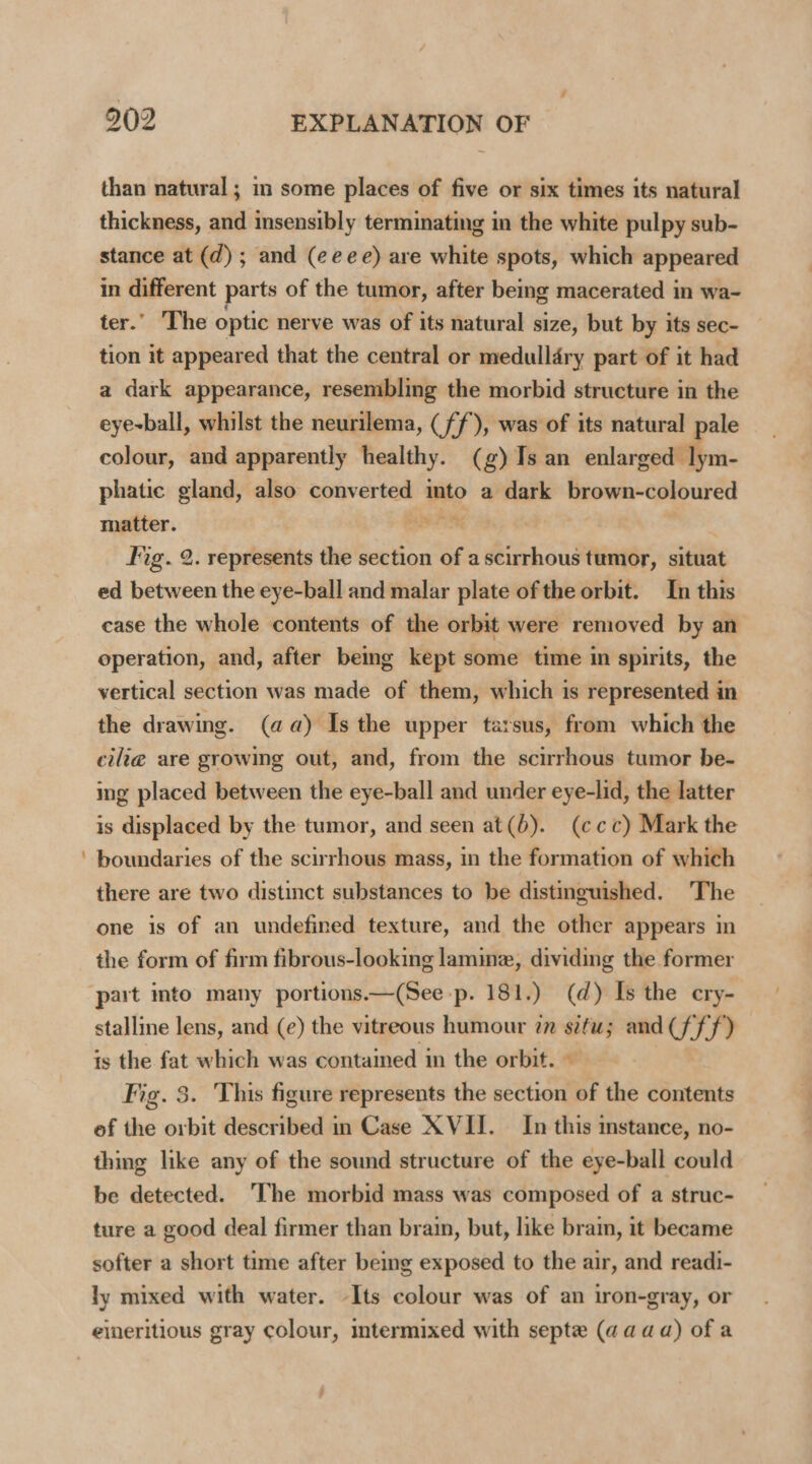 - than natural; im some places of five or six times its natural thickness, and insensibly terminating in the white pulpy sub- stance at (d) ; and (eeee) are white spots, which appeared in different parts of the tumor, after being macerated in wa- ter. The optic nerve was of its natural size, but by its sec- tion it appeared that the central or medulldry part of it had a dark appearance, resembling the morbid structure in the eye~-ball, whilst the neurilema, (ff), was of its natural pale colour, and apparently healthy. (g) Is an ae phatic gland, also converted into a dark brown-coloured matter. ake Jig. 2. represents the section of a scirrhous tumor, situat ed between the eye-ball and malar plate of the orbit. In this case the whole contents of the orbit were removed by an operation, and, after bemg kept some time in spirits, the vertical section was made of them, which is represented in the drawing. (aa) Is the upper tarsus, from which the cili@ are growing out, and, from the scirrhous tumor be- ing placed between the eye-ball and under eye-lid, the latter is displaced by the tumor, and seen at(b). (ccc) Mark the boundaries of the scirrhous mass, in the formation of which there are two distinct substances to be distinguished. ‘The one is of an undefined texture, and the other appears in the form of firm fibrous-looking lame, dividing the former stalline lens, and (e) the vitreous humour a s¢fu; and (fff) is the fat which was contained in the orbit. © Fig. 3. This figure represents the section of the contents of the orbit described in Case XVII. In this instance, no- thing like any of the sound structure of the eye-ball could be detected. ‘The morbid mass was composed of a struc- ture a good deal firmer than brain, but, like brain, it became softer a short time after being exposed to the air, and readi- ly mixed with water. -Its colour was of an iron-gray, or eineritious gray colour, intermixed with septe (aaaa) of a