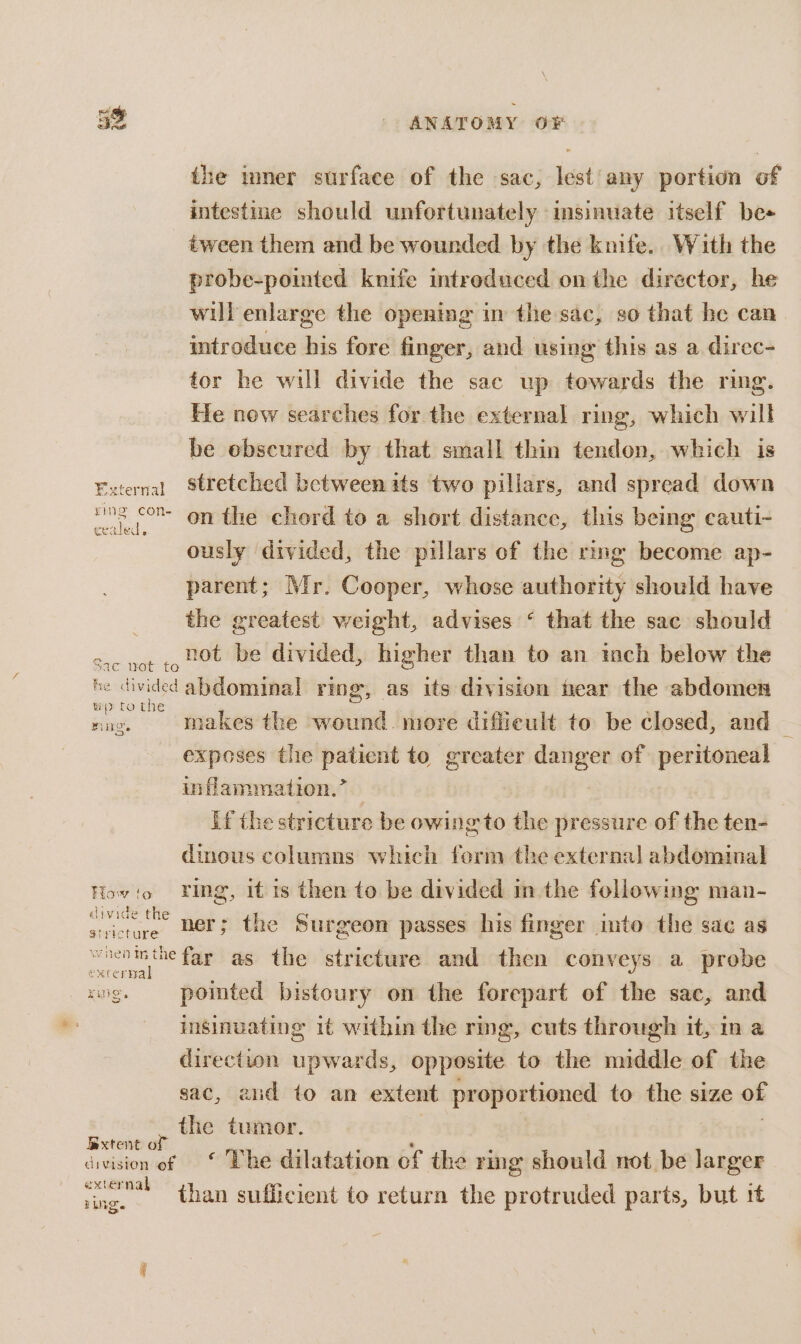 it | eS obs | ANATOMY OF ihe inner surface of the sac, lest’ any portion of intestine should unfortunately insinuate itself be tween them and be wounded by the knife. With the probe-pointed knife intreduced on the director, he will enlarge the opening in the sac, so that be can. introduce his fore finger, and using this as a direc- tor he will divide the sac up towards the ring. He now searches for the external ring, which will be obscured by that small thin tendon, which is External Stretched between its two pillars, and spread down a 6On the chord to a short distance, this being cauti- ously divided, the pillars of the ring become ap- parent; Mr. Cooper, whose authority should have the greatest weight, advises ‘ that the sac should crc not to HOt be divided, higher than to an inch below the te divided abdominal ring, as its division near the abdomen wy&gt; to the ey ; : nag. makes the wound. more difficult to be closed, and exposes the patient to greater danger of peritoneal inflammation.” if the stricture be owing to the pressure of the ten- dineus columns which form the external abdominal How!o Fing, it 1s then to be divided in the following man- wc the ner; the Surgeon passes his finger into the sac as stricture RAS far as the stricture and then conveys a probe excerHa | King. pointed bistoury on the forepart of the sac, and insinuating it within the ring, cuts through it, in a direction upwards, opposite to the middle of the sac, and to an extent proportioned to the size of the tumor. | Bxtent of 7 y ‘ ’ : division of * Lhe dilatation of the rmg should not be larger “xternal than sufficient to return the protruded parts, but if PLING.