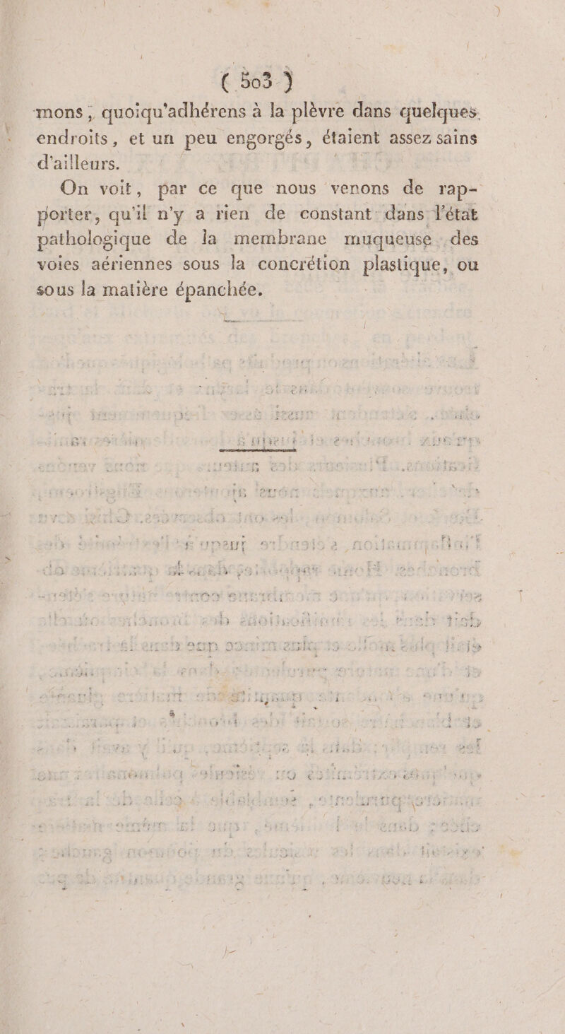 mons , quoiqu'adhérens à la plèvre dans quelques. endroits, et un peu engorgés, étaient assez sains d’ailleurs. de Le On voit, par ce que nous venons de rap- porter, qu'il n'y a rien de constant: dans l'état pathologique de la membrane muqueuse des voies aériennes sous la concrétion plastique, ou sous la matière épanchée, | lose J à €} Ju = \ VITESSE 1] J LE g + ; #8 LOUE RE * k. RE EL ORÉE RSS hd QE + * D 4 ñ 4 j SYrY À 25 | f, FE » $ ETS dé 4 Lis +: Fs LÉ { 1# à } È &amp;L RAT #3 Fu #4 (T+ 4 ‘ ef ñ “#1 PE « É L 2 &amp; : : H î 13 FT ÿ », e 9 AS è € > s +2 Es ji à f 5 Rs