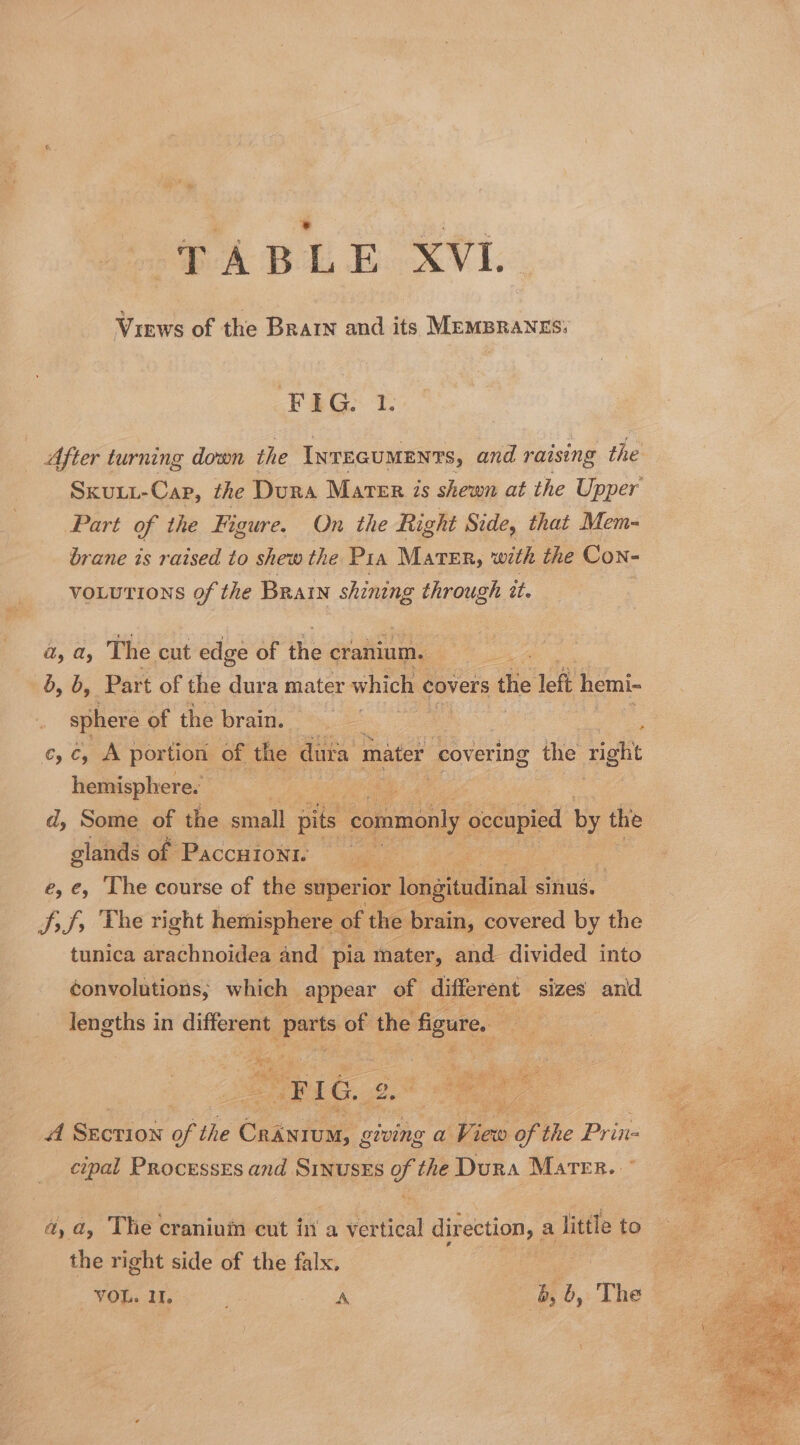 HA BLE A’VI Views of the Brain and its MEMBRANES: VEG T: After turning down the INTEGUMENTS, and raising the Sku-Cap, the Dura Marer is shewn at the Upper Part of the Figure. On the Right Side, that Mem- brane is raised to shew the Pia Mater, with the Con- votutions of the BRAIN shining through tt. a, ay The cut edge of ihe cranium. b, b, Part of the dura mater which ¢ covers the left hemi- sphere of the brain. = : a Cy Cy portion of the dura mater covering the ae hemisphere.’ d, Some of the small pits ‘commonly sere by the glands of Paccuiont. Hae e, €, Lhe course of the superior longitudinal sinus. SS; The right hemisphere « of the brain, covered by the tunica arachnoidea and pia mater, and. divided into convolutions, which appear of different sizes and lengths in different “parts of the figure, ay z ey 2, a 2 es | Section He the inte. civing a Lice of the Prin: cipal Processes and SinusES of the Dura Mater. ° a,a, The cranium cut in a Vertical direction, ; a little to the right side of the falx. | VOR. Me ae b, i, The