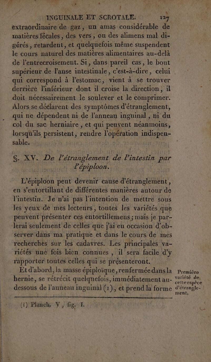 — ——niTE.[|.-ito;,eei{8t1 * Sigillo eo ————— ne &gt; Mi i, | Né extraordinaire de gaz, un amas considérable de matières fécales , des vers, ou des alimens mal di- gérés , retardent, et quelquefois même suspendent le cours naturel des matières alimentaires au-delà de l’entrecroisement. Si, dans pareil cas, le bout doit nécessairement le soulever et le comprimer. Alors se déclarent des symptômes d’étranglement, qui ne dépendent ni de l’anneau ARE ES du col du sac herniaire , et qui peuvent néanmoins, lorsqu’ ils persistent, rendre FRA TOR indispen- sable. | S. XV. De l'étranglement je FRA Dar l’épiploon. L’épiploon peut devenir cause d' étranglement , en s’entortillant de différentes manières autour de l'intestin. Je n'ai pas l'intention de mettre sous ies yeux de mes lecteurs, toutes les variétés que peuvent présenter ces Bereich; mais je par- server dans ma pratique et dans le cours de mes recherches sur les cadavres. Les priricipalés va- riétés uné fois bien connues , il sera facile d'y rapporter toutes celles qui sé MEG EhI STONE Et d’abord, la masse épiploique, renfermée dans la hernie, se rétrécit quelquefois, immédiatement au- date de l'anneau inguinal (1), et prend la forme (î) Planch, V, fig. I. Première variété de cette espè ce d’ étrangle- ment,
