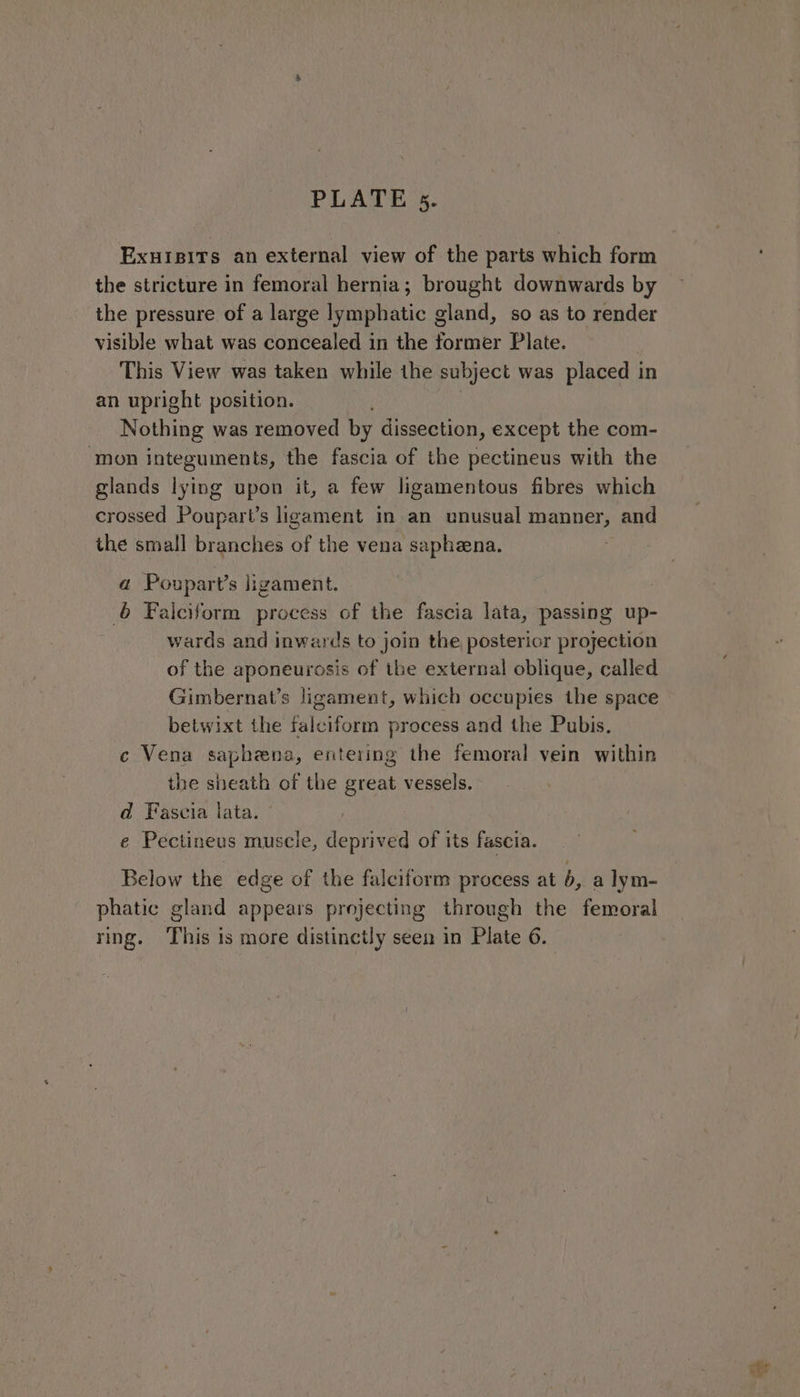 Exuisits an external view of the parts which form the stricture in femoral hernia; brought downwards by the pressure of a large lymphatic gland, so as to render visible what was concealed in the former Plate. This View was taken while the subject was placed in an upright position. Nothing was removed by dissection, except the com- ‘mon integuments, the fascia of the pectineus with the glands lying upon it, a few ligamentous fibres which crossed Poupart’s ligament in an unusual manner, and the small branches of the vena saphena. a Poupart’s ligament. 6 Falciform process of the fascia lata, passing up- wards and inwards to join the posterior projection of the aponeurosis of the external oblique, called Gimbernat’s ligament, which occupies the space betwixt the falciform process and the Pubis. c Vena saphena, entering the femoral vein within the sheath of the great vessels. d Fascia lata. e Pectineus muscle, deprived of its fascia. Below the edge of the falciform process at 6, a lym- phatic gland appears projecting through the femoral