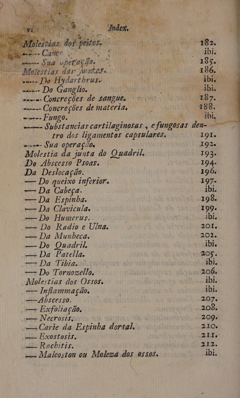 ad A bd his pppr== Sua. upécação. Ra | | EA Si 185. * Molestias das unip£ a DURE aÃ 186. O amas Do Hydarthruse E aba Poe -.-Do Gangilios 4 usina “bh ena-a- ConcreÇÕES de SANGUE sos 187. ecmam Concreções de materia PLANA 188. eme FUNGO. E t Ibi, e Substancias cartilaginosas , efungosas den- tro dos ligamentos capsulares, I9I. vce SUA Operação 192 Molestia da junta do Quadril. 193. Do Abscesso Psoas. 194. Da Deslocação. 196. — Do queixo inferior. 197. —— Da Cabeça. ibi. — Da Espinha. 198. — Da Clavicula. . | 199. — Do Humerns. ibi, — Do Radio e Ulma. 2od; — Da Munheca. | 202. — Do Quadril ibi. cet Da Pareila. 205. srt Da Tibia. ibi. — Du Tornozello, | sy 7 206. Molestias des Oss08 ibi. -— Inflammação, ibi. — dbscesso. | xo A — Exfoliação, us 208. — Necrosis. “209. «—sCarie da Eupinta dorsal, 210 —— Exostosis. 211. dt Rachita go 212. e Maleoston on Moleza dos 05505. ibi. :