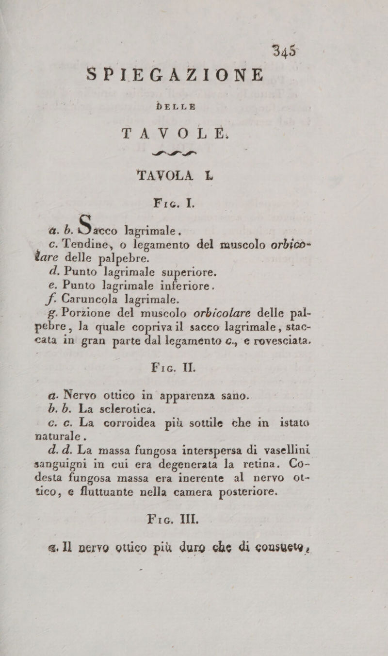 SPIEGAZIONE DELLE TAVOLE: SO SE TAVOLA L Fic. I. a. b. Sc lagrimale . c.'Tendine, o legamento del muscolo orbico- tare delle palpebre. d, Punto lagrimale superiore. e. Punto lagrimale ro. f. Caruncola lagrimale. g. Porzione del muscolo orbicolare delle pal- pebre, la quale copriva il sacco lagrimale, stac- cata in gran parte dal legamento c., e rovesciata. Fia. ILL a. Nervo ottico in apparenza sano. b. b. La sclerotica. c. c. La corroidea più sottile che in istato naturale . d. d. La massa fungosa interspersa di vasellini sanguigni in cui era degenerata la retina. Co- desta fungosa massa era inerente al nervo ot- tico, € fluttuante nella camera posteriore. Fic. II. 4.11 nervo guico più duro che di consueta,