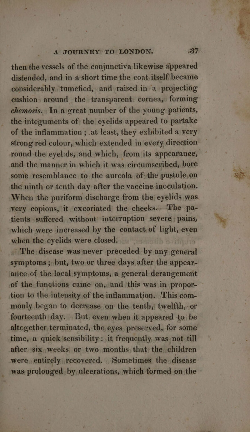 then the vessels of the conjunctiva likewise appeared distended, and in a short time the coat, itself became considerably tumefied, and raised in “a projecting cushion: around the transparent; cornea, forming chemosis. In agreat number of the young: patients, the integuments of; the eyelids appeared to partake of the inflammation ; .at least, they exhibited a very strong red colour, which extended in'every direction and the manner in which it was circumscribed, bore some resemblance to the aureola of- the pustule,on the ninth or tenth day after the vaccine inoculation. When the puriform discharge from the’ eyelids was very copious, it excoriated the cheeks.- ‘The pa- tients suffered without’ interruption severe ; pains, which were increased by the contact of light, even when the eyelids were closed: | - The disease was never preceded by any eticcal iliacotees ; but, two or three days after the appear- arice,of the local symptoms, a general derangement of the functions came on,. and ‘this was in propor- tion to the intensity of the inflammation. This com- monly began to decrease ‘on the tenth,! twelfth,-.or fourteenth day. . But. even when it appeared to be altogether, terminated, the eyes, preserved, for some time, a quick ‘sensibility :. it frequently, was not till after ‘six weeks. or two months, that: the children were .entirely recovered. Sometimes the. disease was prolonged by ulcerations, which formed on the