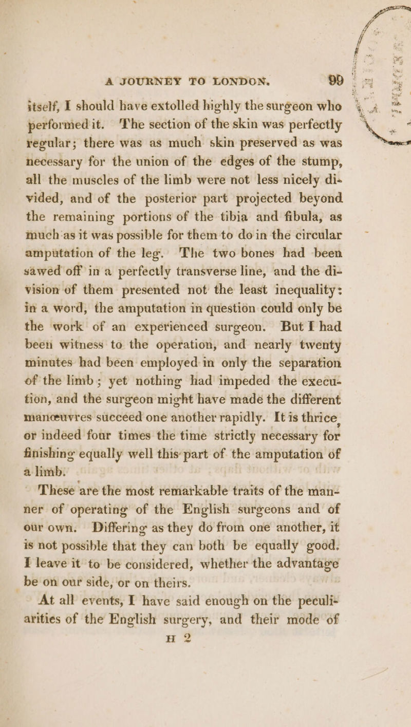 performed it. ‘The section of the skin was perfectly regular; there was as much skin preserved as was necessary for the union of the edges of the stump, all the muscles of the limb were not less nicely di- vided, and of the posterior part projected beyond the remaining portions of the tibia and fibula, as muchas it was possible for them to doin the circular amputation of the leg. The two bones had been sawed off in a perfectly transverse line, and the di- vision of them presented not’ the least inequality: in a word, the amputation in question could only be the work of an experienced surgeon. But fT had been witness to the operation, and nearly twenty minutes had been employed:in only the separation of the limb; yet nothing had impeded the execu- tion, and the surgeon might have made the different mariceuvres succeed one another rapidly. It is thrice, or indeed four times the time strictly necessary for finishing equally well this: part of the amputation of a limb. , _ These are the most remarkable traits of the man- ner of operating of the English surgeons and of ourown. Differing as they do from one another, it is not possible that they can both be equally good. I leave it to be considered, whether the advantage _be on our side, or on theirs. At all events, I have said enough on the peculi- arities of the English surgery, and their mode of H 2 —