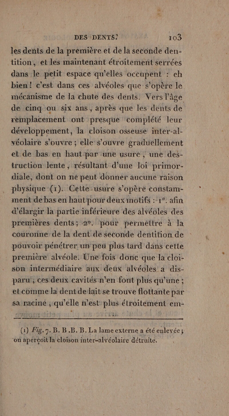 les dents de la première et de la seconde den- tition, et les maintenant étroitement serrées dans le petit espace qu’elles occupent : eh bien! c’est dans ces alvéoles que s'opère le mécanisme de la chute des dents. Vers l’âge de cinq ou six ans, après que les dents de remplacement ont presque complété leur développement, la cloison osseuse inter-al- véolaire s'ouvre ; elle: s'ouvre graduellement et de bas en haut'par ‘une usure , une des- truction lente , résultant d'une loi primor- diale, dont on ne peut donner aucuné raison physique (1). Cette -usuré s’opèré constam- ment debas en haut pour deux motifs :’r°. afin d'élargir la partie inférieure des alvéoles des premières dents; 2°. poûür perméttre à la courorine: de la dent de seconde dentition de pouvoir pénétrer uti peu plus tard dans cette première alvéole. Une fois donc que la cloi- son intermédiaire aux deux alvéoles à dis- paru ; ces derix cavités n’en font plus qu'une ; etcomme la dent delait se trouve flottante par sa racine , qu'elle n’est plus étroitement em- = (1) Fig.7. B. B.B. B. La lame externe a été enlevée ; on aperçoit la cloison inter-alvéolaire détruite. \