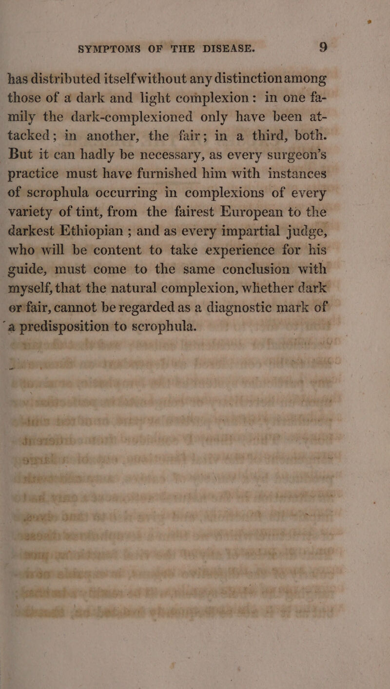 has distributed itselfwithout any distinction among those of a dark and light complexion: in one fa- mily the dark-complexioned only have been at- tacked; in another, the fair; in a third, both. But it can hadly be necessary, as every surgeon’s practice must have furnished him with instances of scrophula occurring in complexions of every variety of tint, from the fairest European to the darkest Ethiopian ; and as every impartial judge, who will be content to take experience for his guide, must come to the same conclusion with myself, that the natural complexion, whether dark er fair, cannot be regarded as a diagnostic mark of ‘a predisposition to scrophula. : wo NG) eae