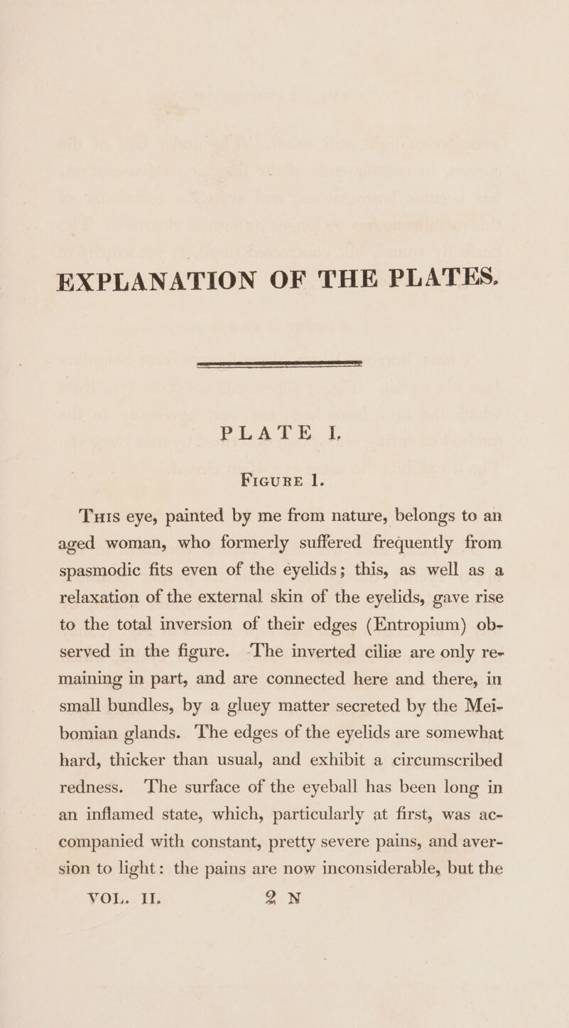 EXPLANATION OF THE PLATES. PES ft is. |. FicuRreE l. Tuis eye, painted by me from nature, belongs to an aged woman, who formerly suffered frequently from spasmodic fits even of the eyelids; this, as well as a relaxation of the external skin of the eyelids, gave rise to the total inversion of their edges (Entropium) ob- served in the figure. “The inverted cilize are only re- maining in part, and are connected here and there, in small bundles, by a gluey matter secreted by the Mei- bomian glands. The edges of the eyelids are somewhat hard, thicker than usual, and exhibit a circumscribed redness. The surface of the eyeball has been long in an inflamed state, which, particularly at first, was ac-~ companied with constant, pretty severe pains, and aver- sion to light: the pains are now inconsiderable, but the VOL. Il. In